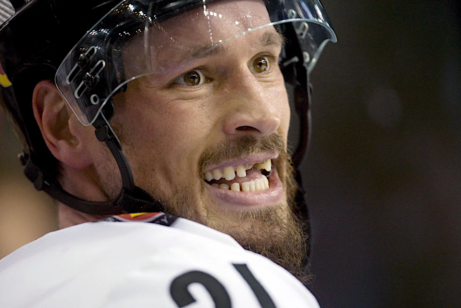 John Tripp, ehemaliger deutscher Eishockey-Nationalspieler, hat im Laufe seiner Profikarriere Zähne eingebüßt. Ähnliches blüht Menschen, die an Parodontose leiden.