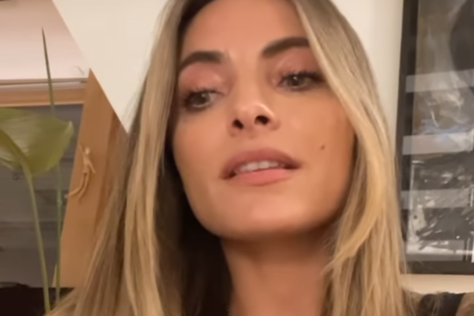 Sophia Thomalla berichtet auf Instagram, dass sie unter venöser Malformation leidet, einer unheilbaren Krankheit.