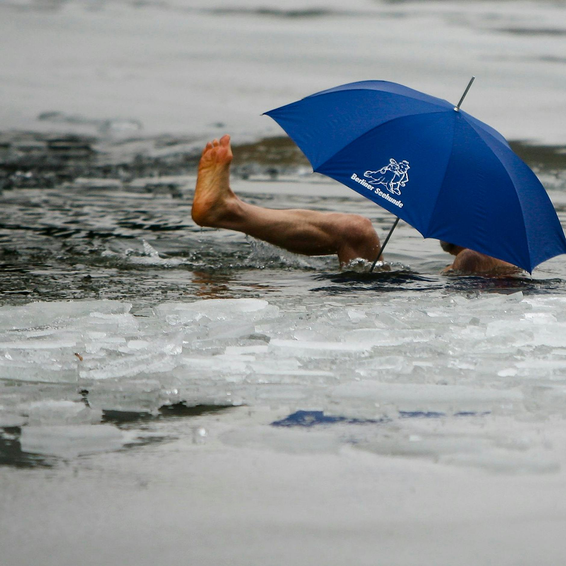 Bin ich in der Gaskrise im Vorteil, weil ich an Alpha-Actinin-3-Mangel leide?