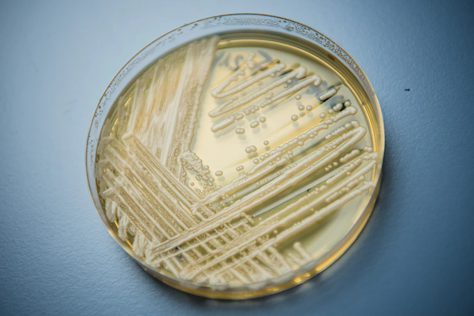 Der Hefepilz Candida auris in einer Petrischale.