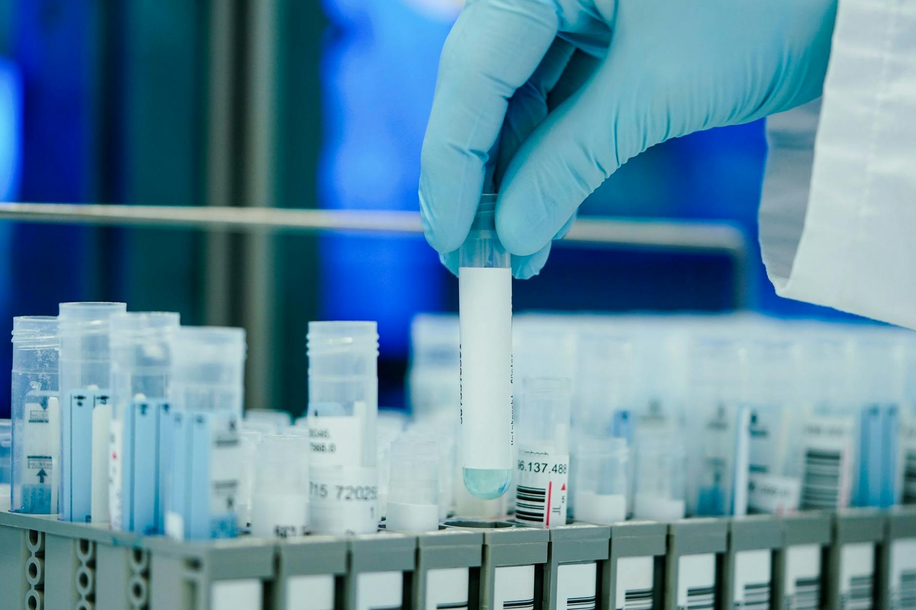 ARCHIV - Ein Mitarbeiter hält in einem Coronatest-Labor PCR-Teströhrchen in den Händen.