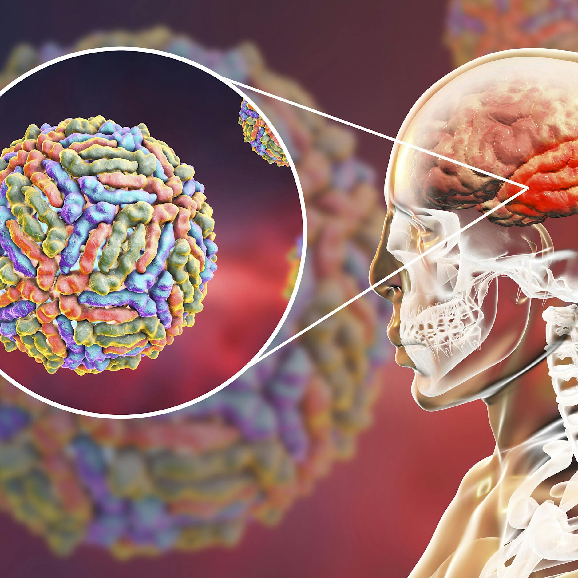 Robert Koch-Institut warnt: West-Nil-Virus schlägt besonders gern im Osten zu