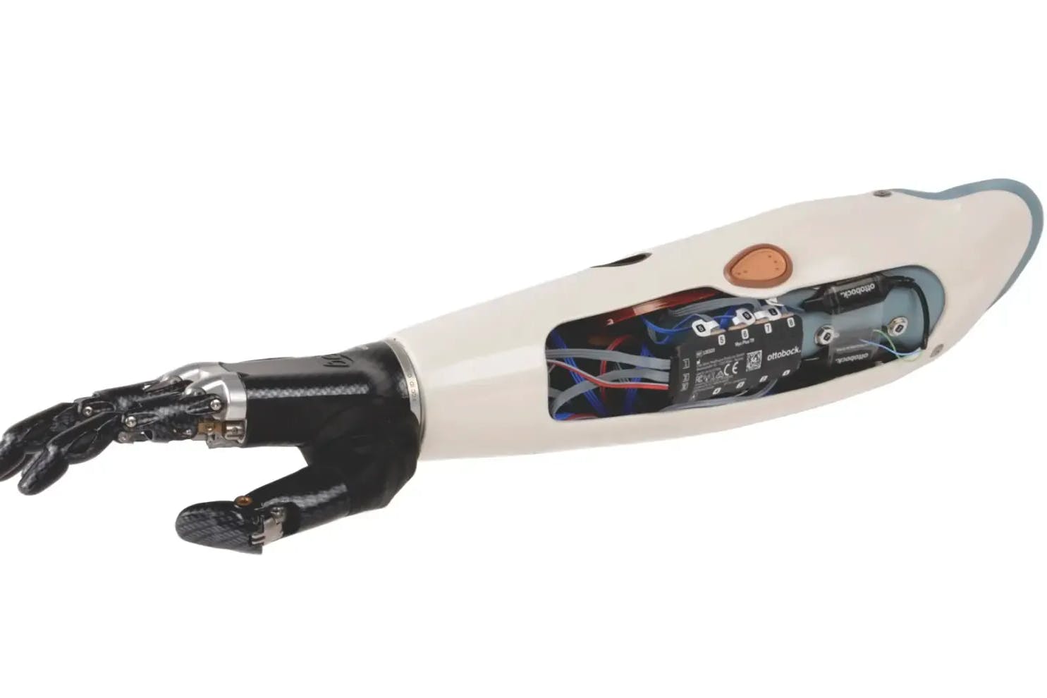 Der Unterarm Myo Plus von Ottobock ist ein mit künstlicher Intelligenz ausgestattetes Spitzenprodukt, das über die europaweit erste Prothesensteuerung mit Mustererkennung verfügt.