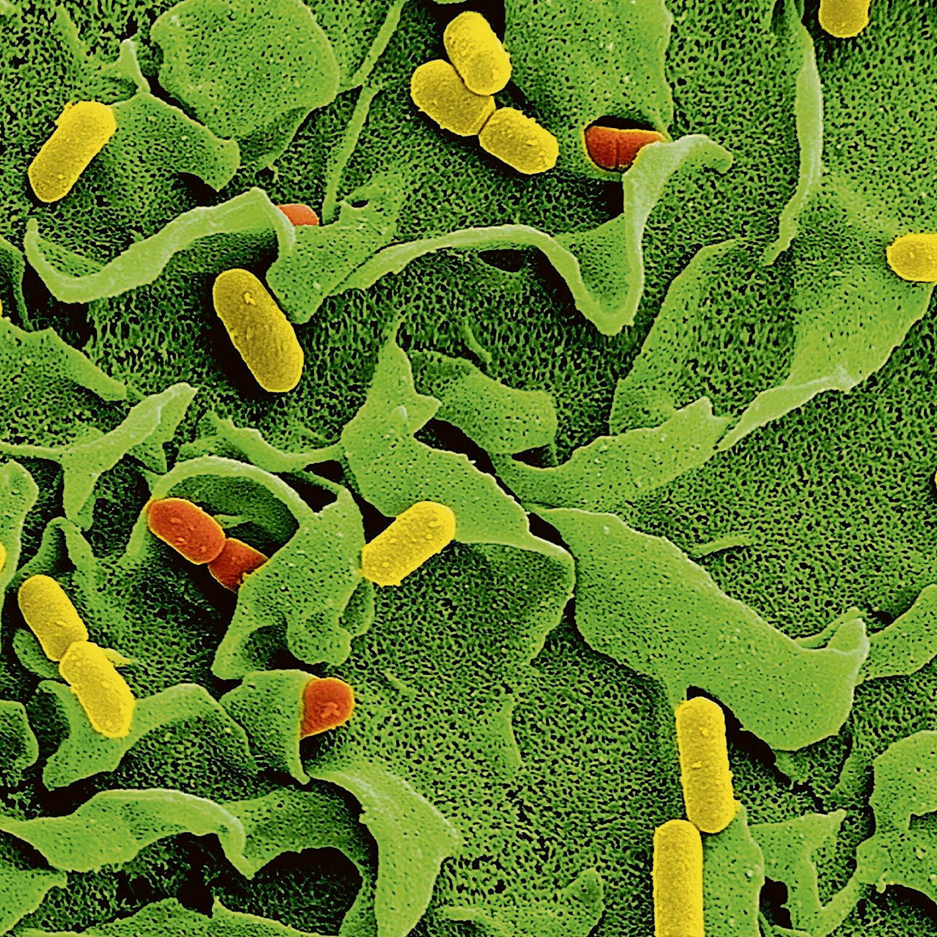 Künstliche Intelligenz könnte Antibiotika der Zukunft entwerfen
