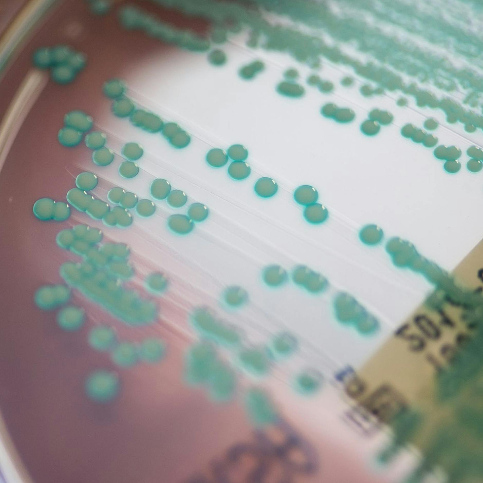 Pandemie ohne Ende: 35.000 Tote durch Antibiotikaresistenzen