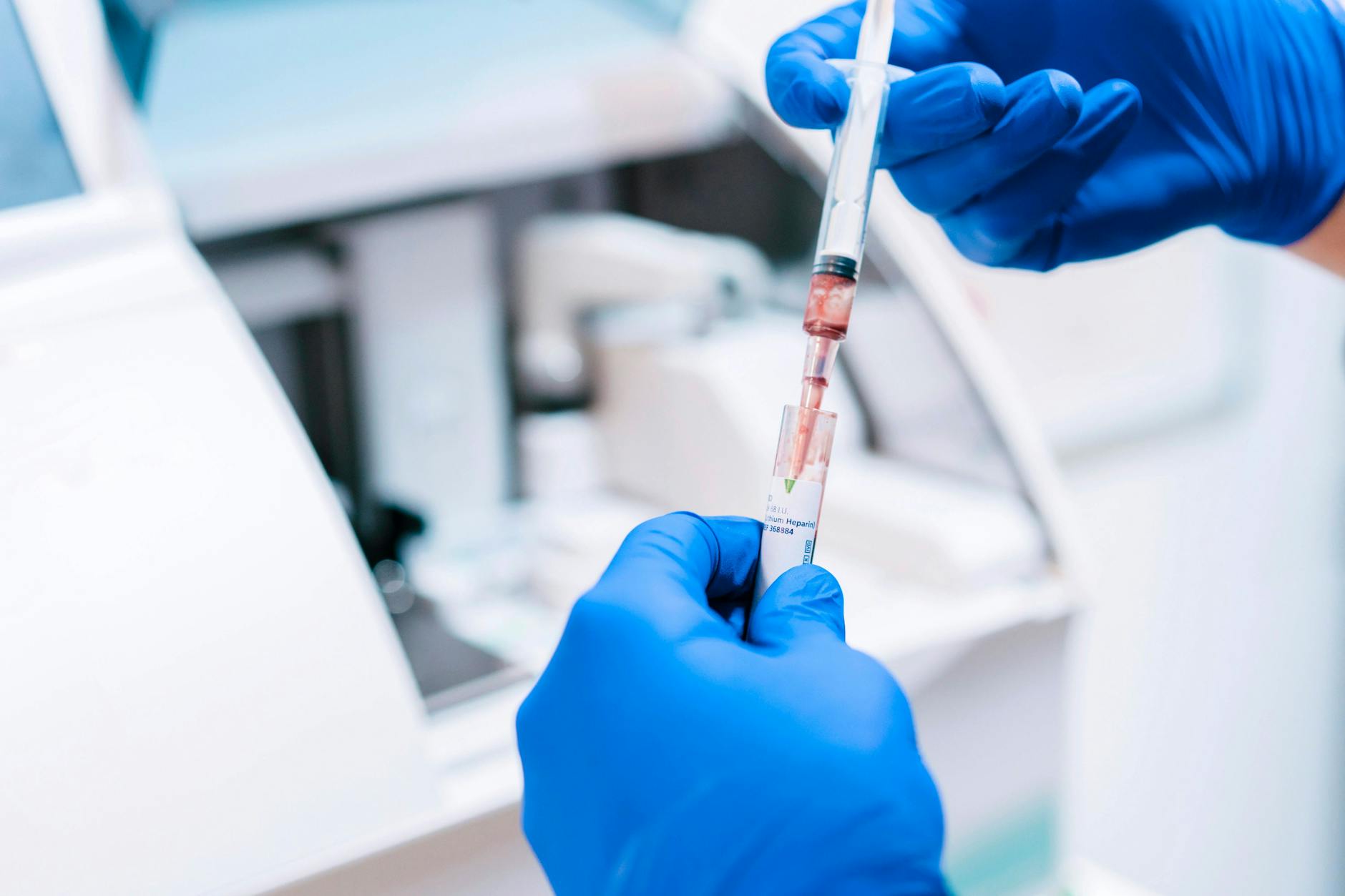 Hemgenix wurde kürzlich als Wirkstoff gegen Hämophilie B in den USA zugelassen und gilt jetzt als teuerstes Medikament der Welt.