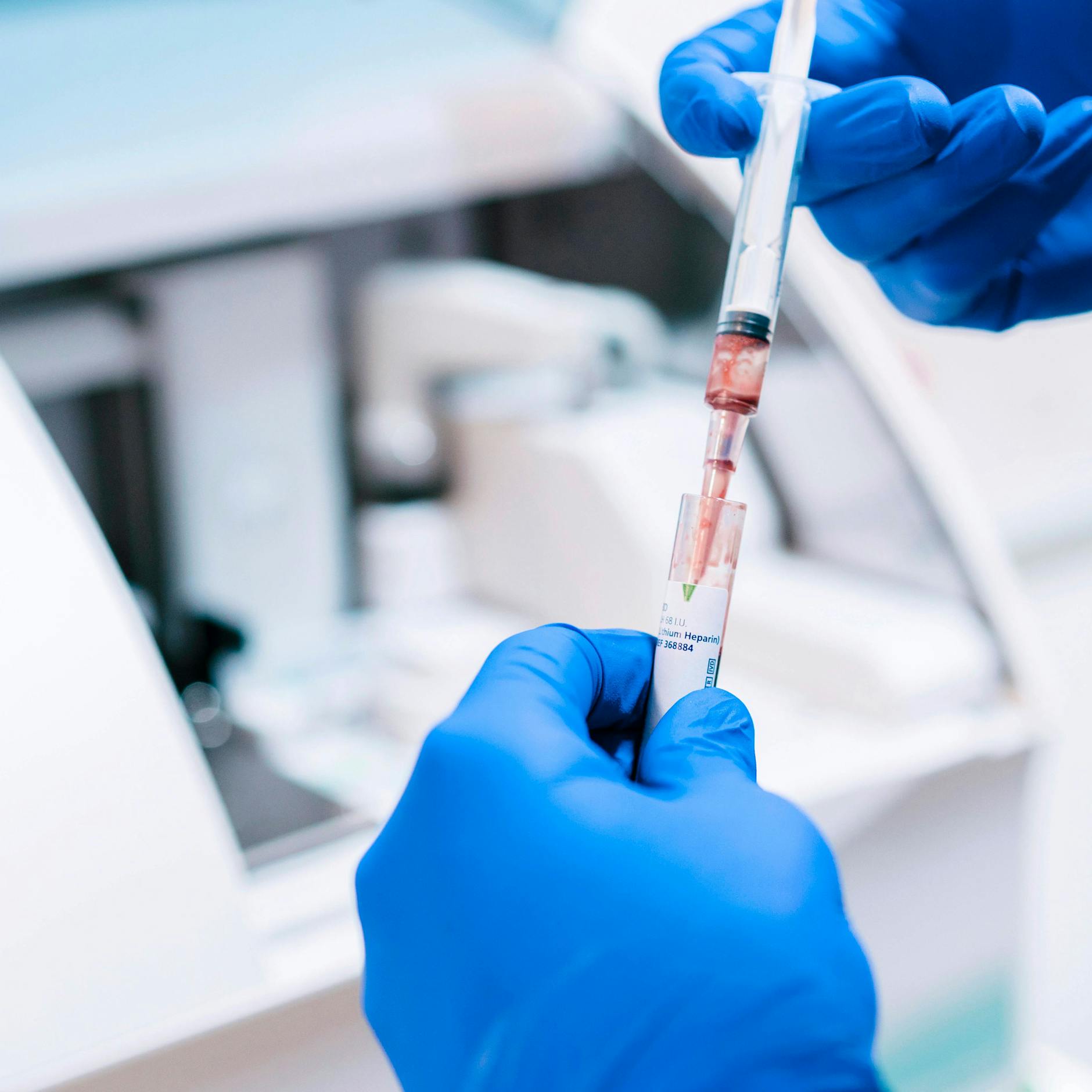 3,5 Millionen Dollar pro Dosis: Teuerstes Medikament der Welt soll auch helfen, Geld zu sparen