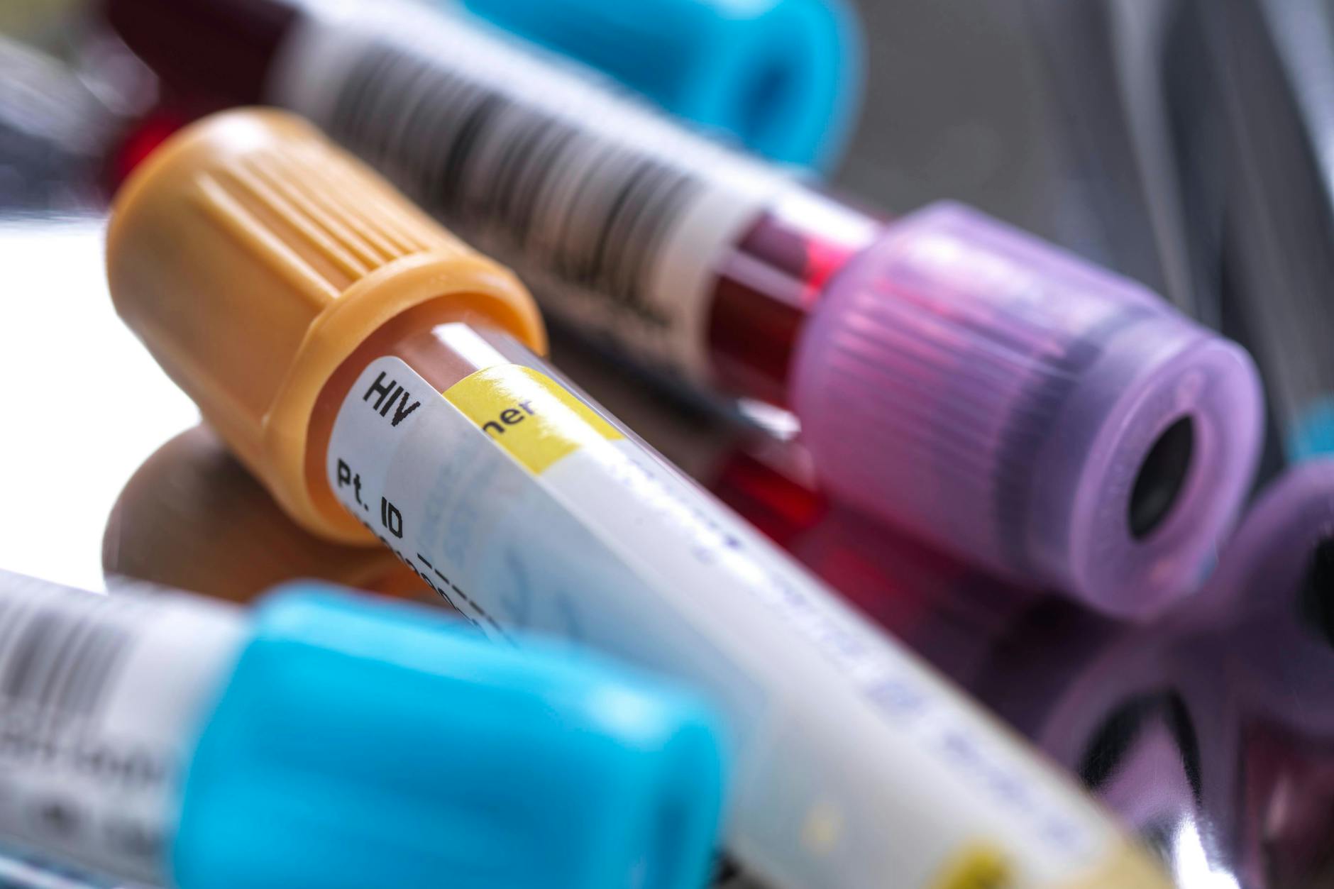 Regelmäßige Blutuntersuchungen gehören dazu.