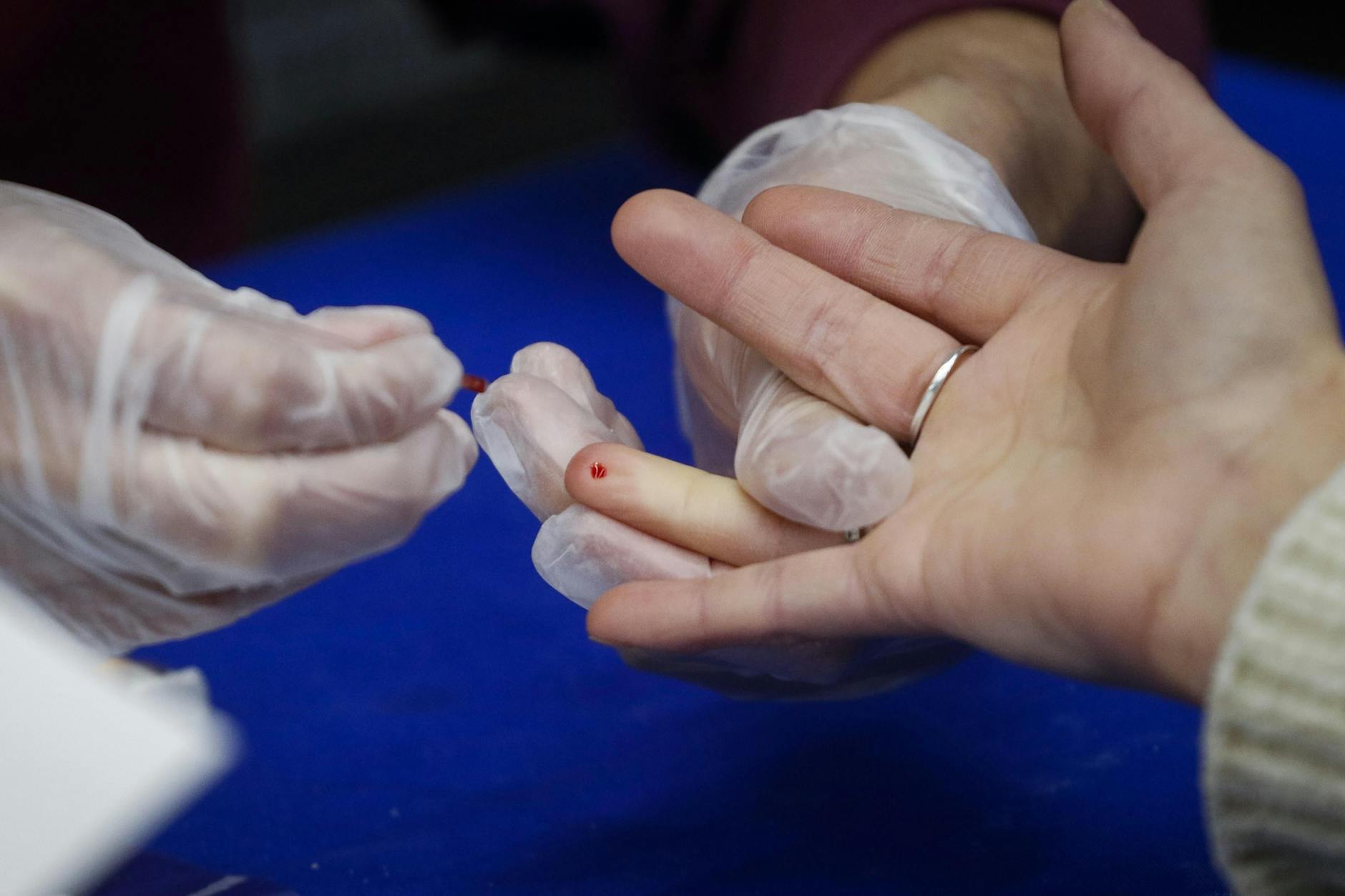 Blutabnahme für einen HIV-Schnelltest.