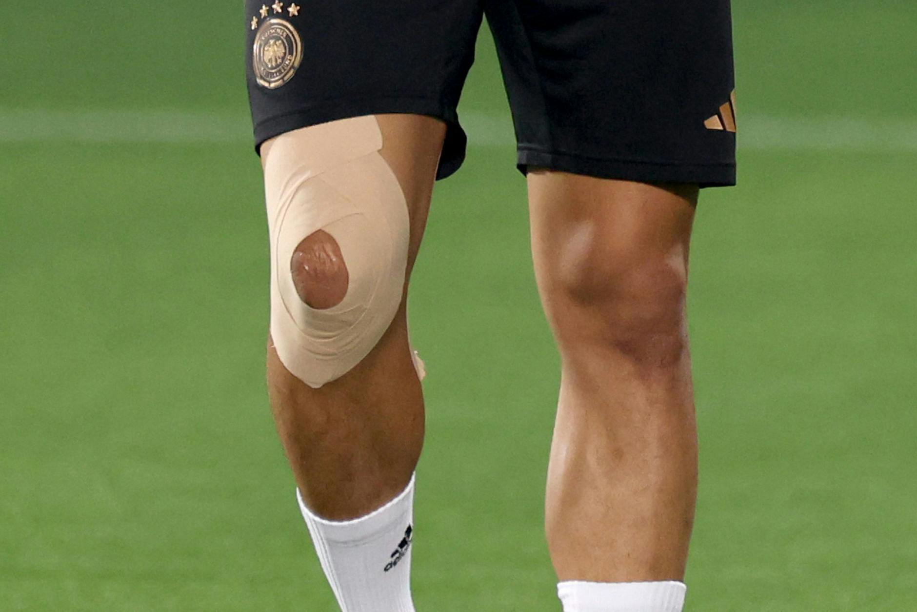 Das lädierte Knie von Nationalspieler Leroy Sané.