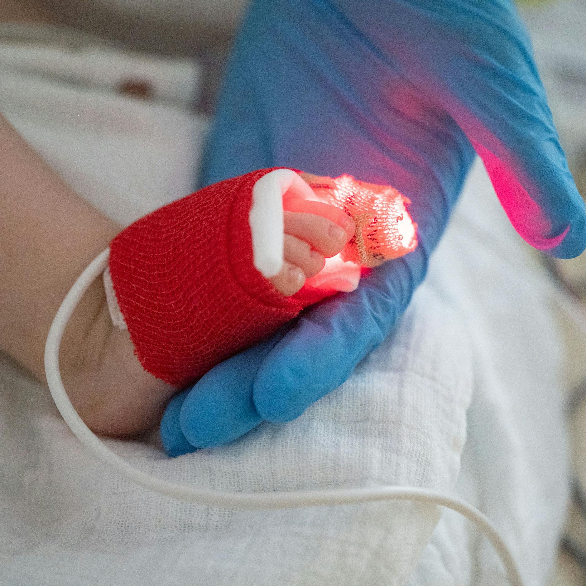 RSV und Personalmangel: Charité Berlin richtet Notversorgung für Kinder ein