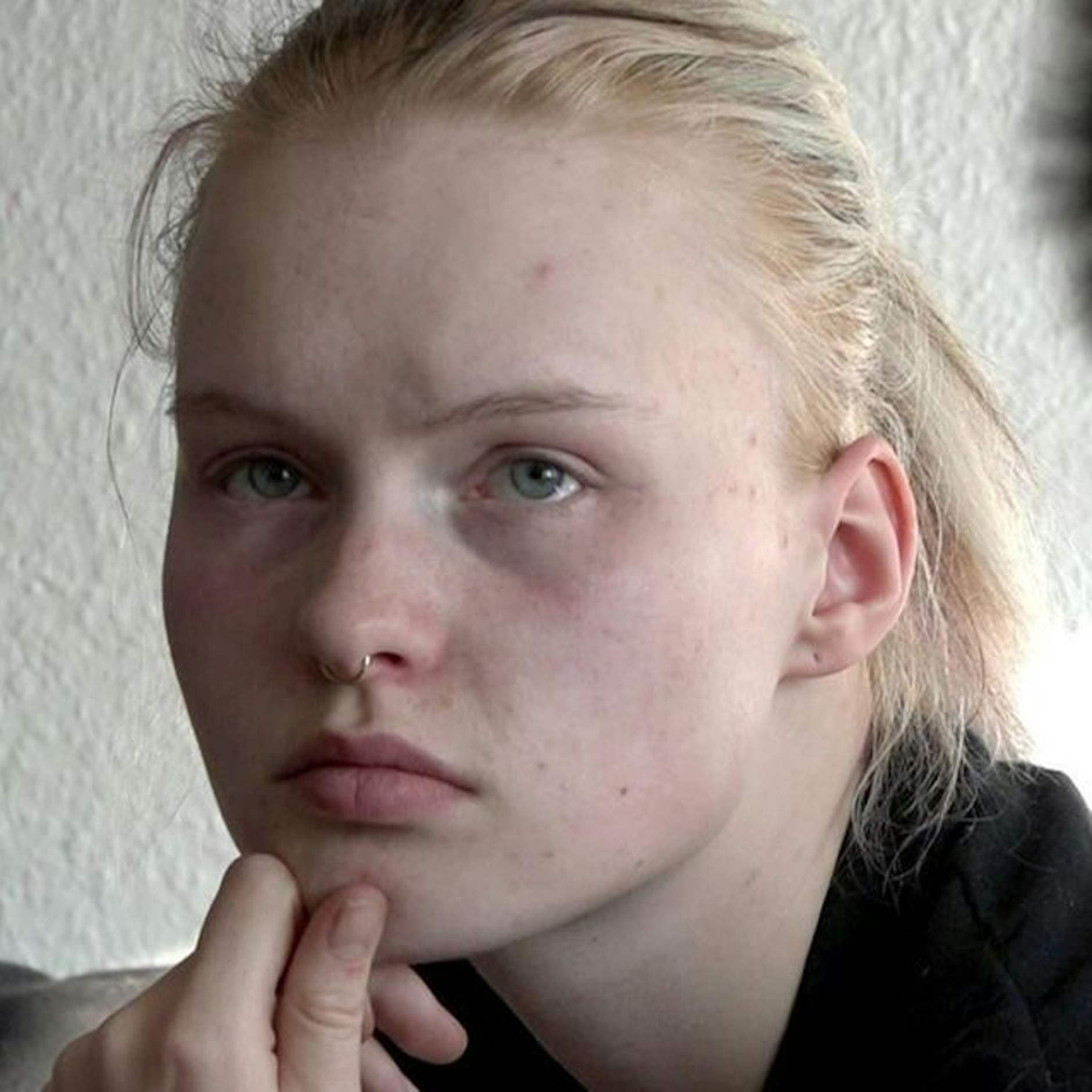 "Hartz aber herzlich": Cindy hat viel durchgemacht.