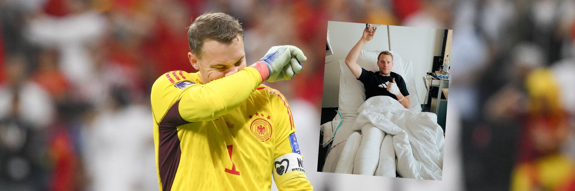 Bitter: Auf den WM-Frust folgte für Manuel Neuer eine OP, nachdem er sich bei einer Skitour den Unterschenkel brach. 