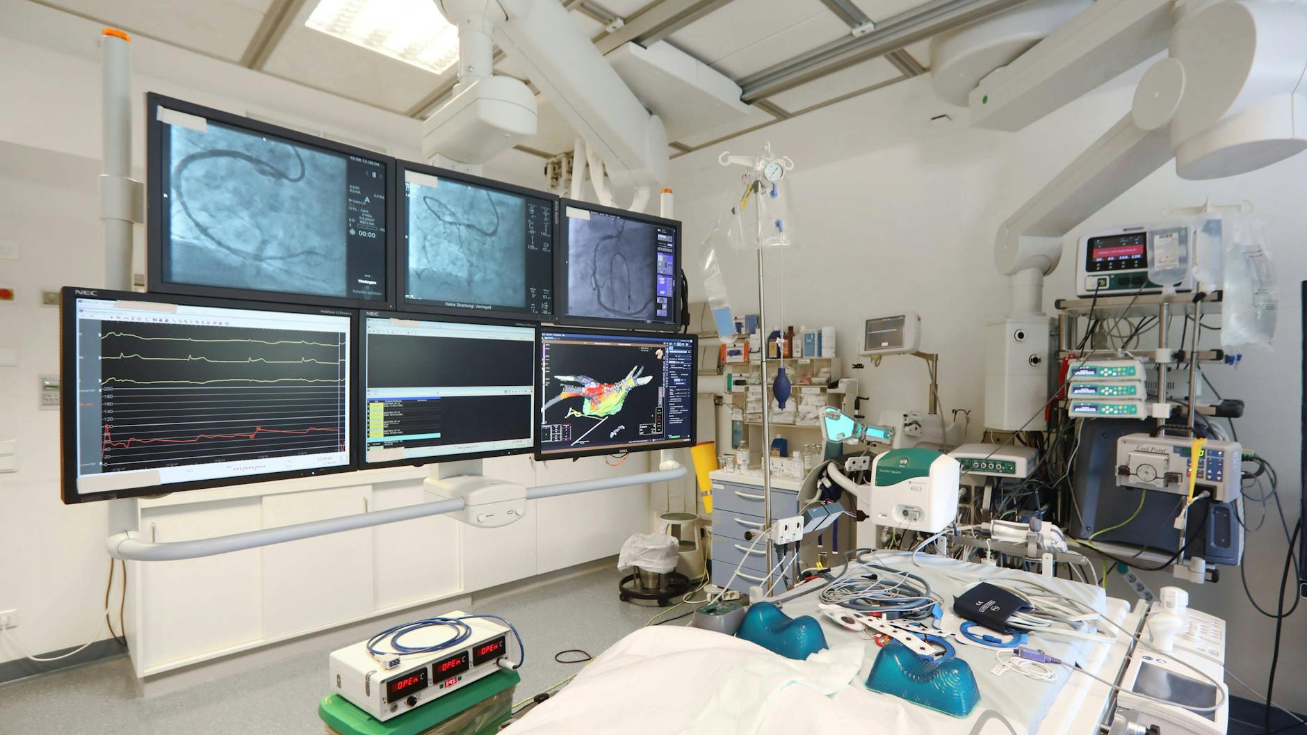 Im Herzkatheterlabor der Oberhavel-Kliniken Henningsdorf. Es ist rund um die Uhr verfügbar. Dort wurden im Jahr 2020 370 Patienten behandelt.