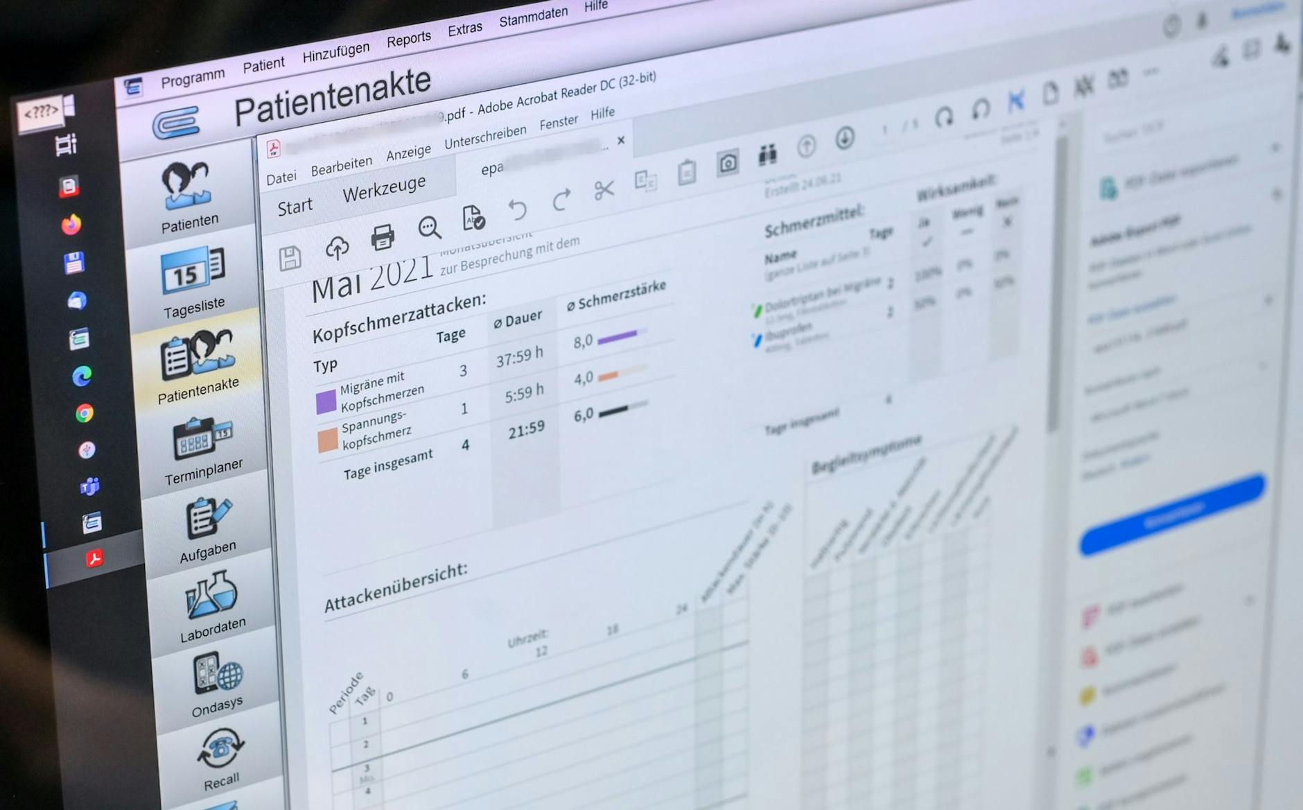 ARCHIV - Elektronische Patientenakten werden etwa für Arztbefunde und Röntgenbilder genutzt.