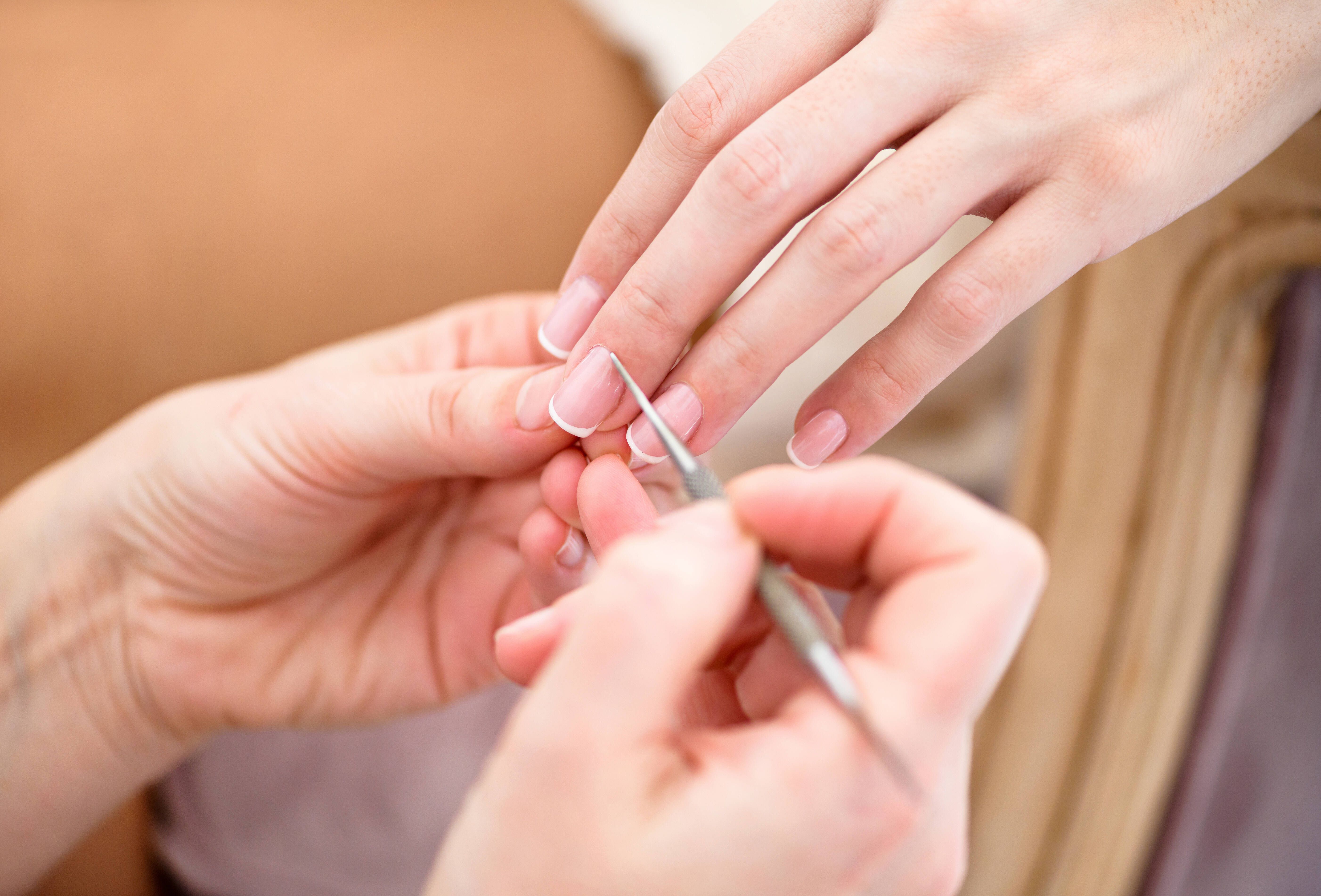 Rillen, Flecken oder Verfärbungen: Das verraten Ihre Fingernägel über Ihre Gesundheit