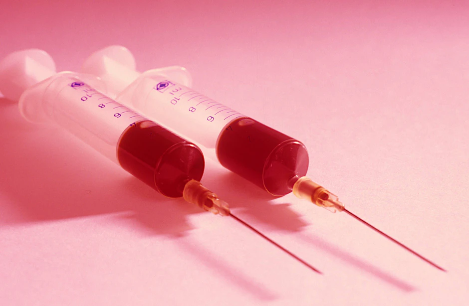 Vor der Behandlung kommt die Spritze: Für ein „Vampire Lifting“ wird erstmal Blut abgenommen.