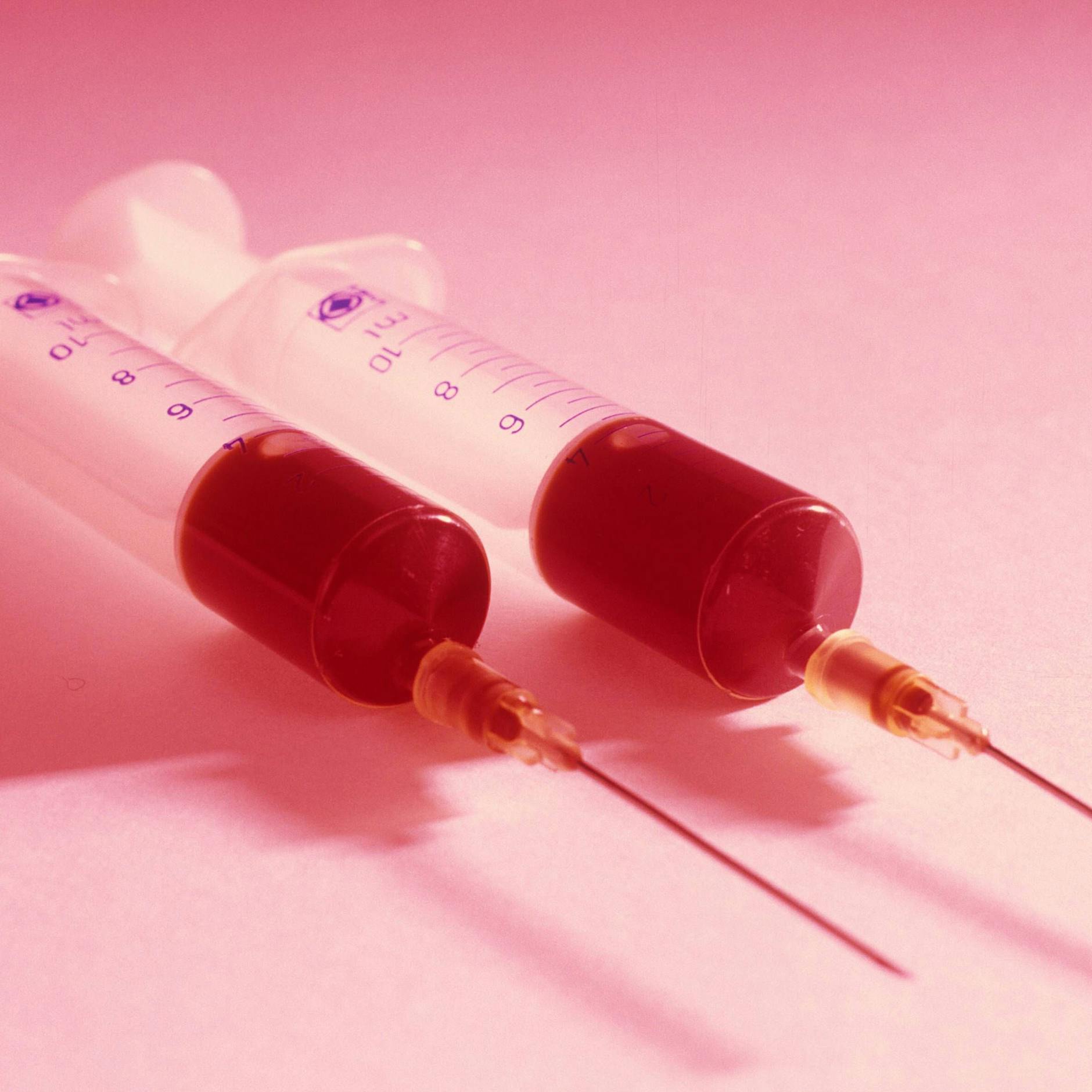 „Vampire Lifting“: So fühlt sich Microneedling an