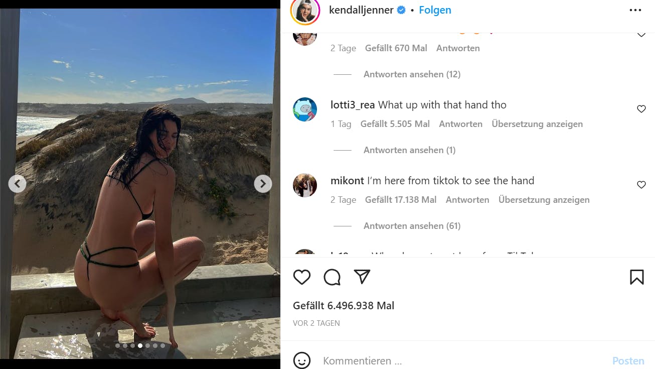 Die Follower fragen sich, was da mit Kendall Jenners Hand passiert ist.