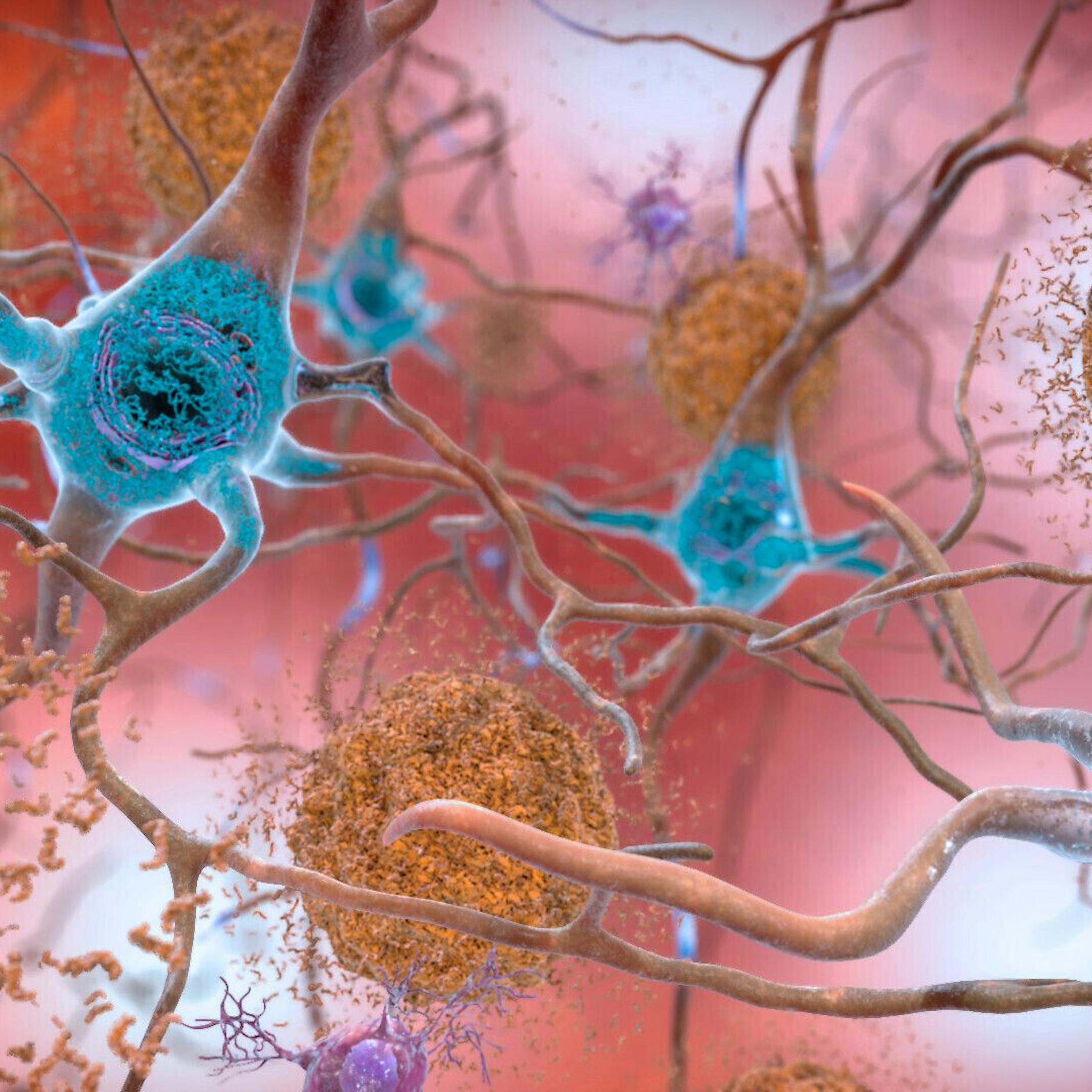 Neue Studie: „Ur-menschlicher Überlebensinstinkt“ im Gehirn führt zu Alzheimer