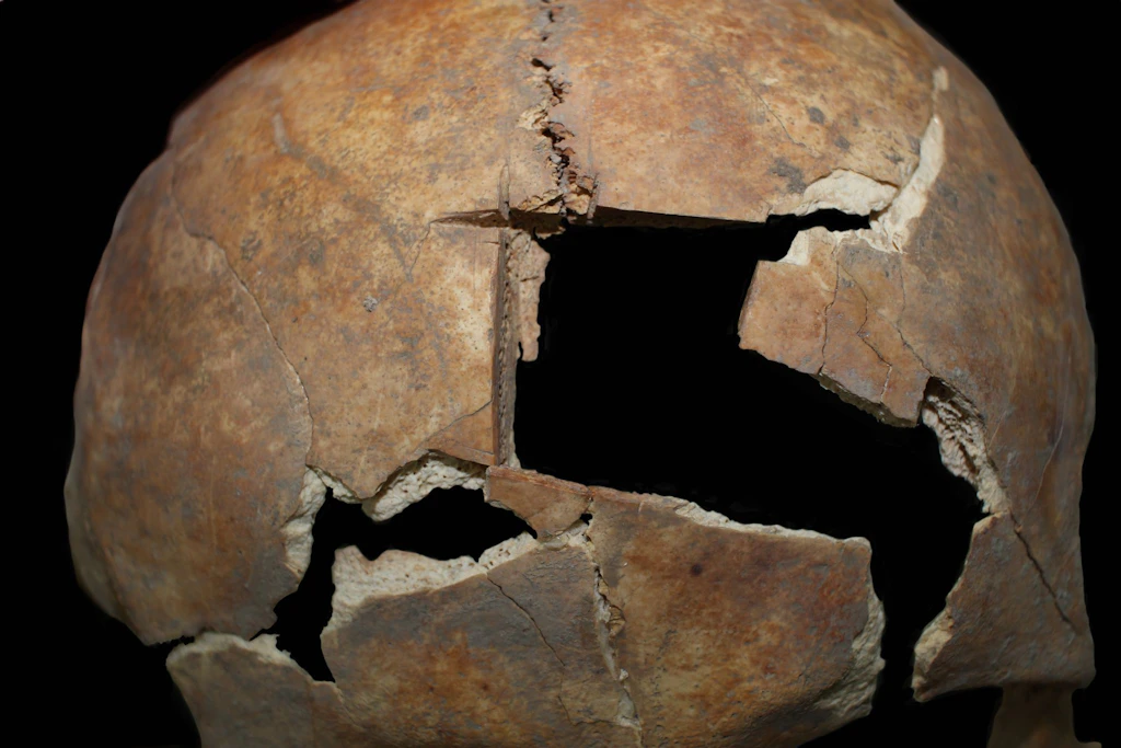 Bronzezeit: Mann vor etwa 3500 Jahren an Schädel operiert