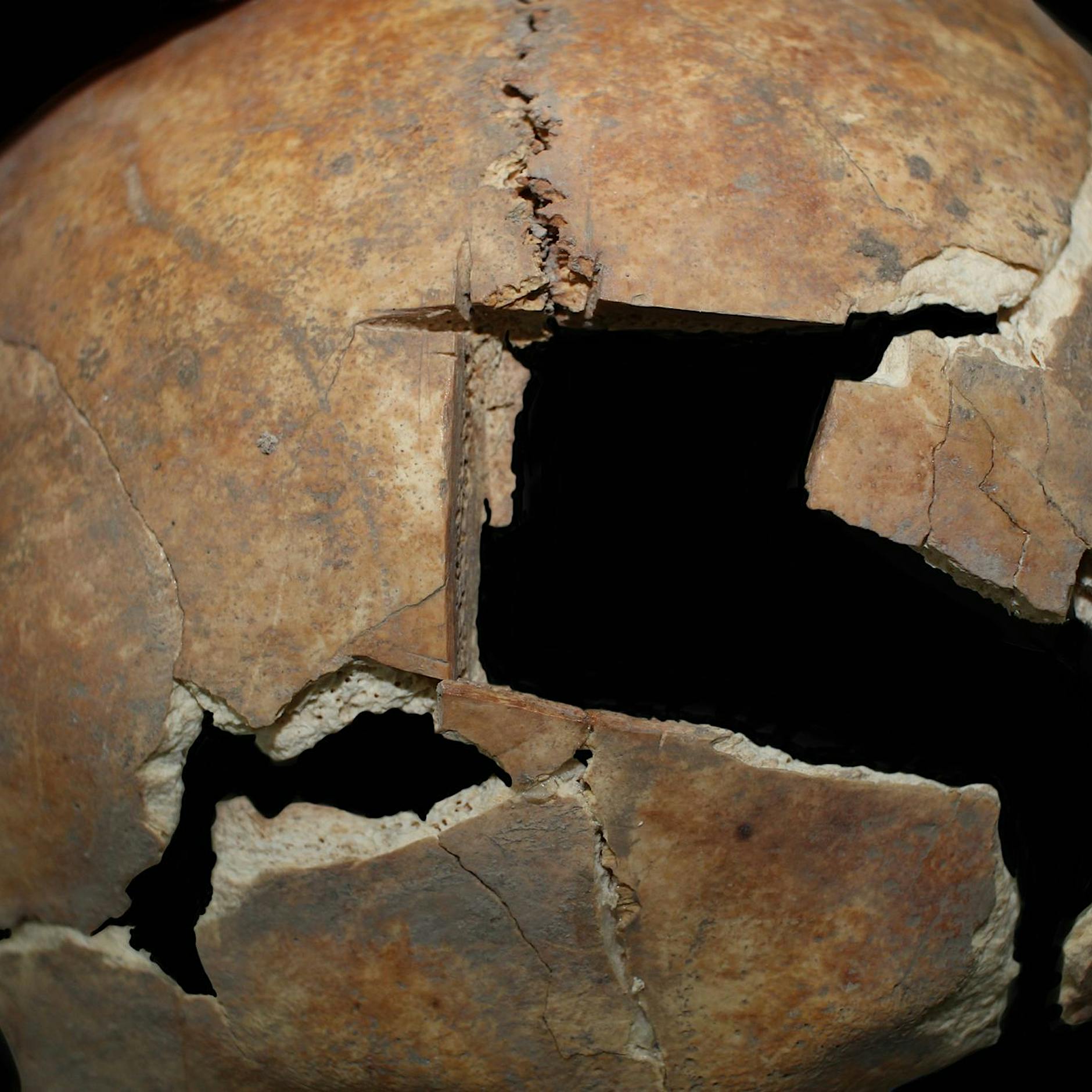 Bronzezeit: Mann vor etwa 3500 Jahren an Schädel operiert