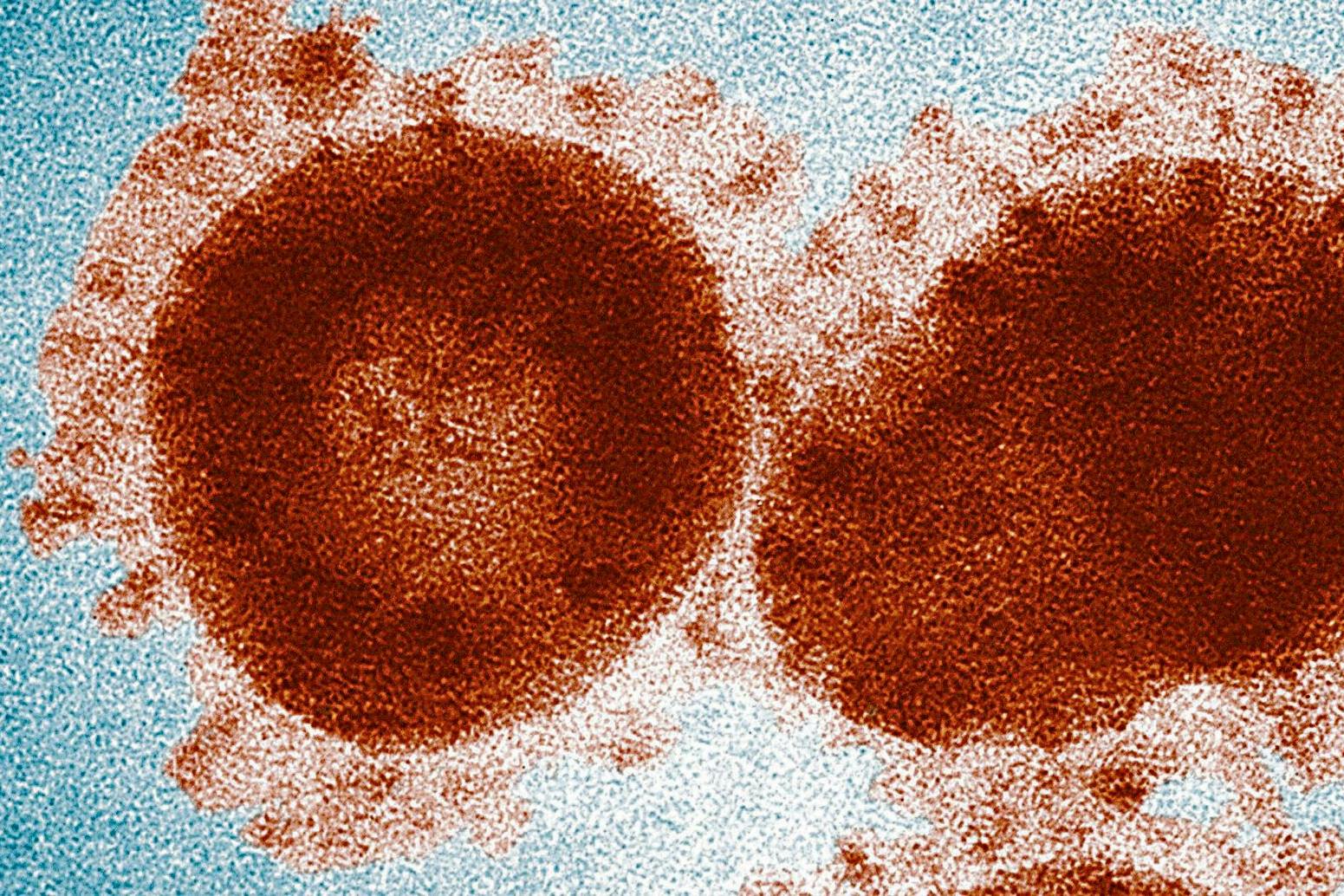 Großaufnahme eines Coronavirus