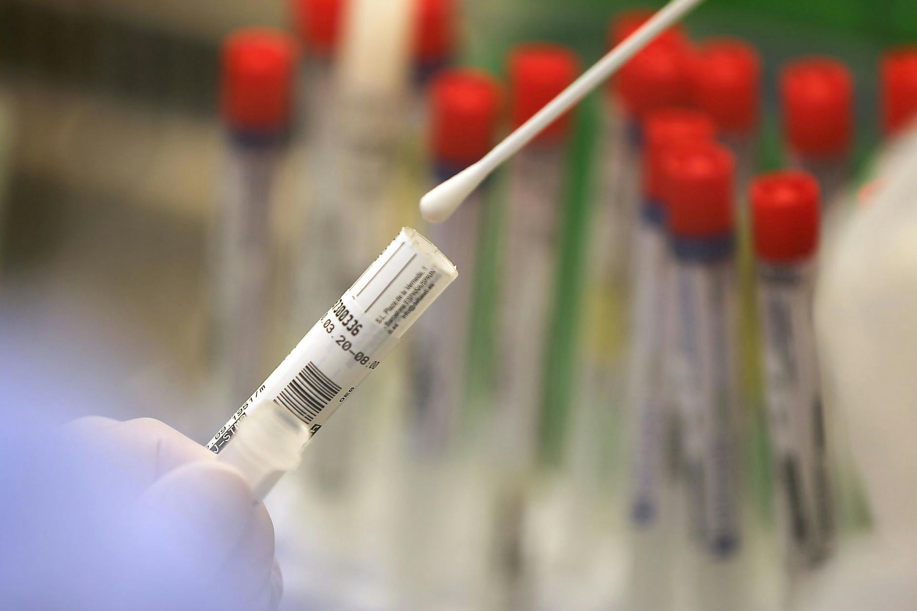 In einem Labor wird ein Abstrich auf das Coronavirus untersucht.