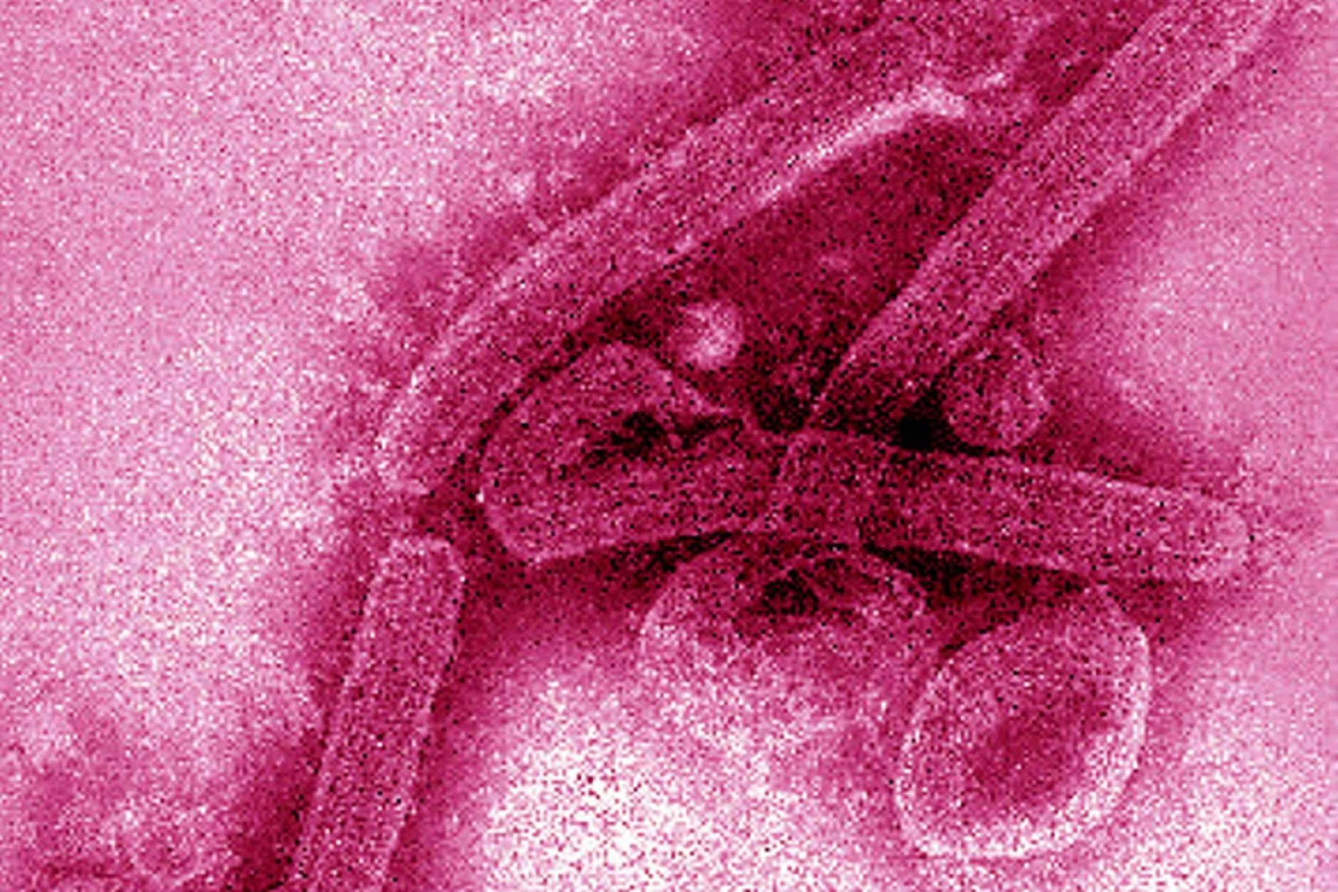 Mikroskop-Bild des Marburg-Virus: Es wurde von den Behörden als Verursacher ausgeschlossen.