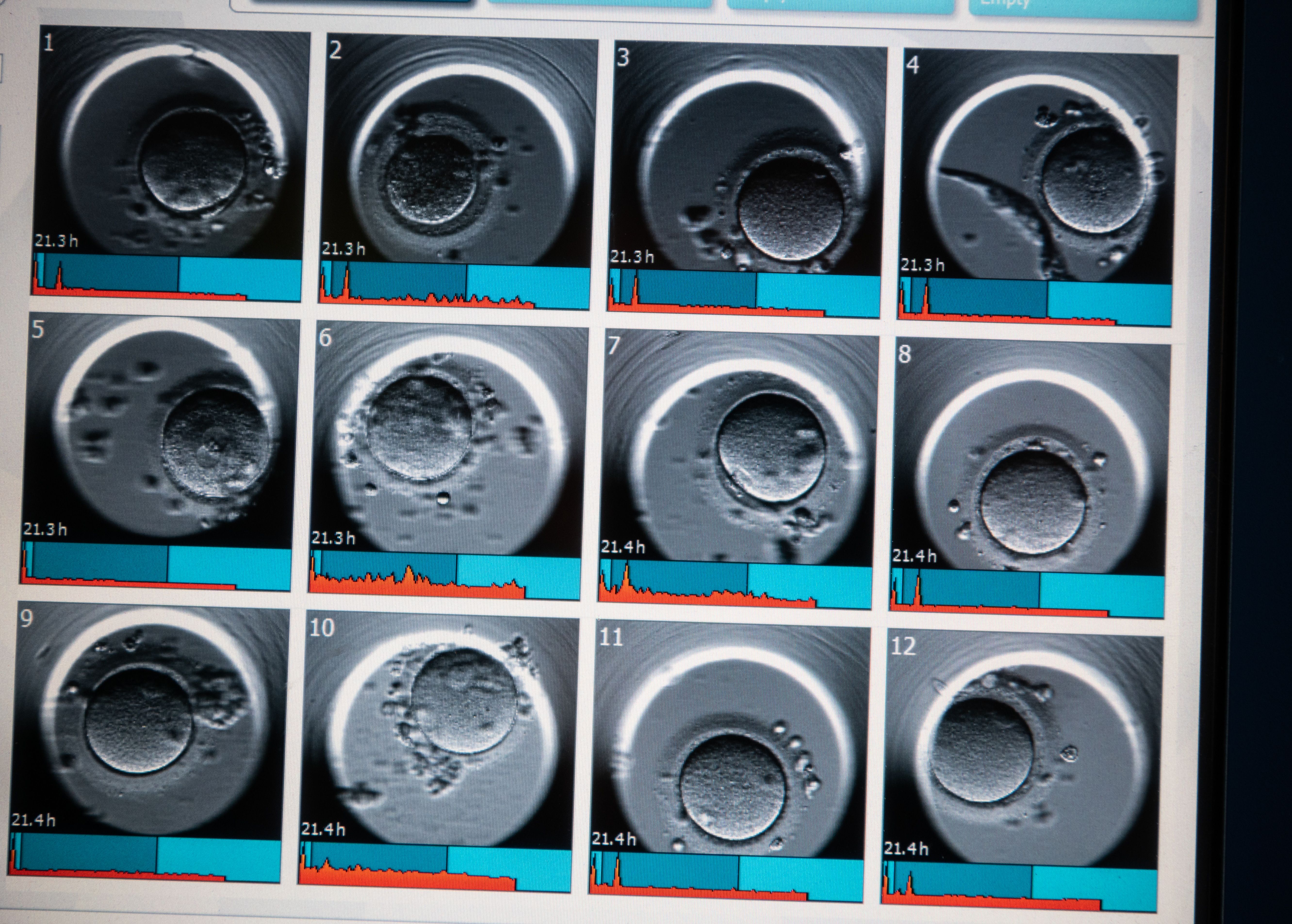 Image - Samenspender hat über 550 Kinder gezeugt