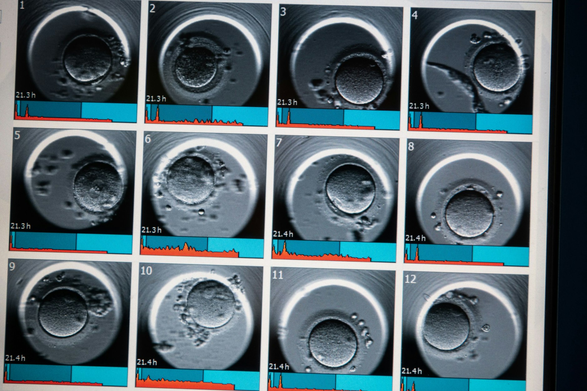 Auf einem Monitor sind Aufnahmen von Embryonen zu sehen (Symbolbild).