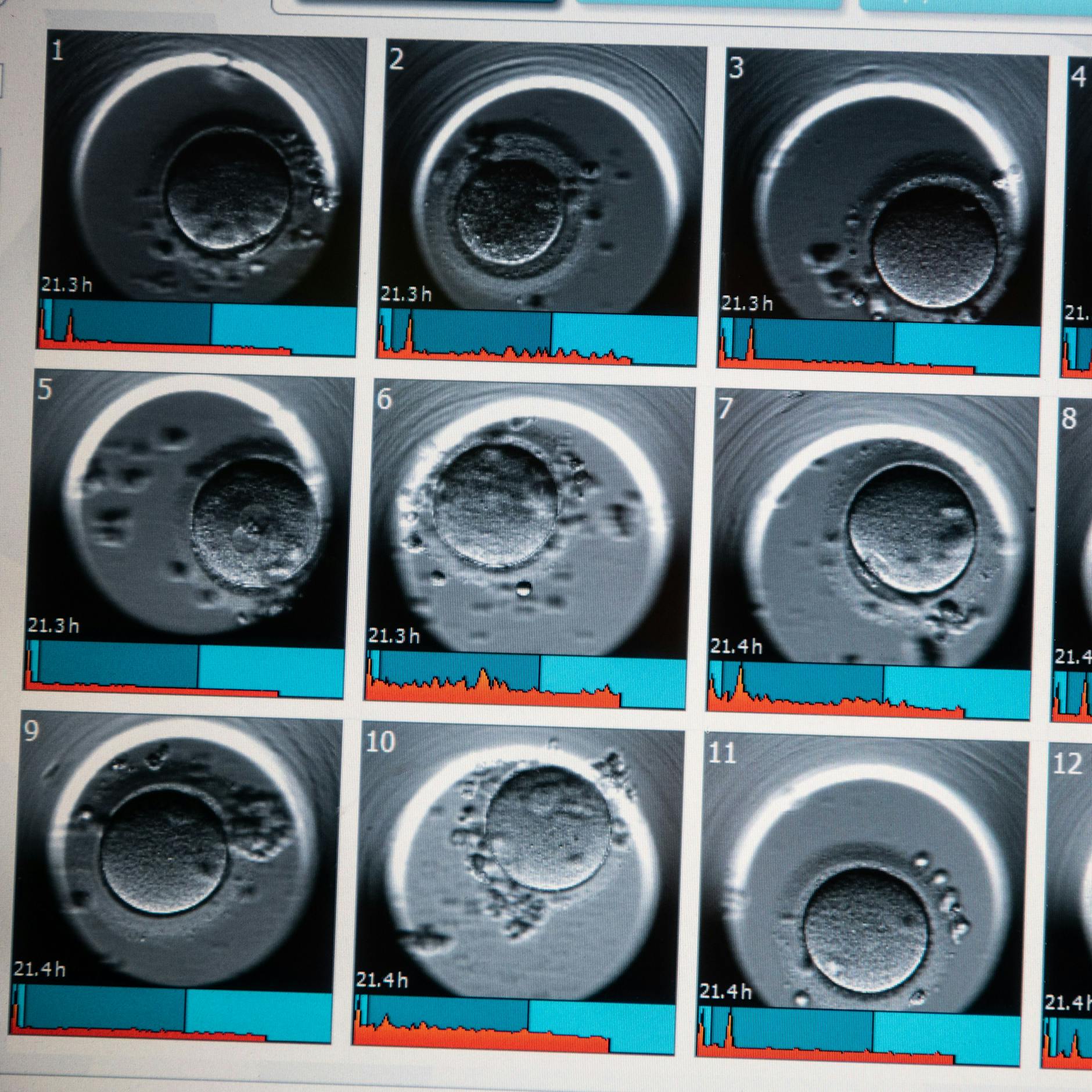 Samenspender hat über 550 Kinder gezeugt