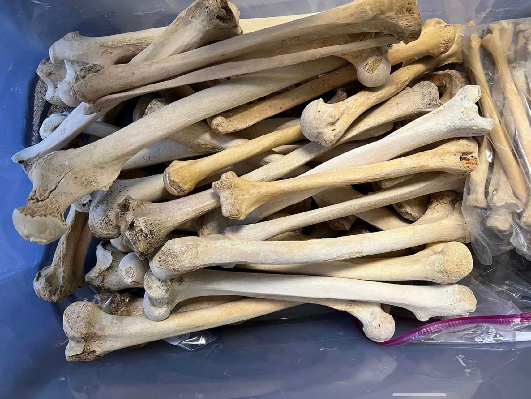 Image - Föten, Gehirne, falsche Brüste: Frau verkauft 20 Kisten Leichenteile