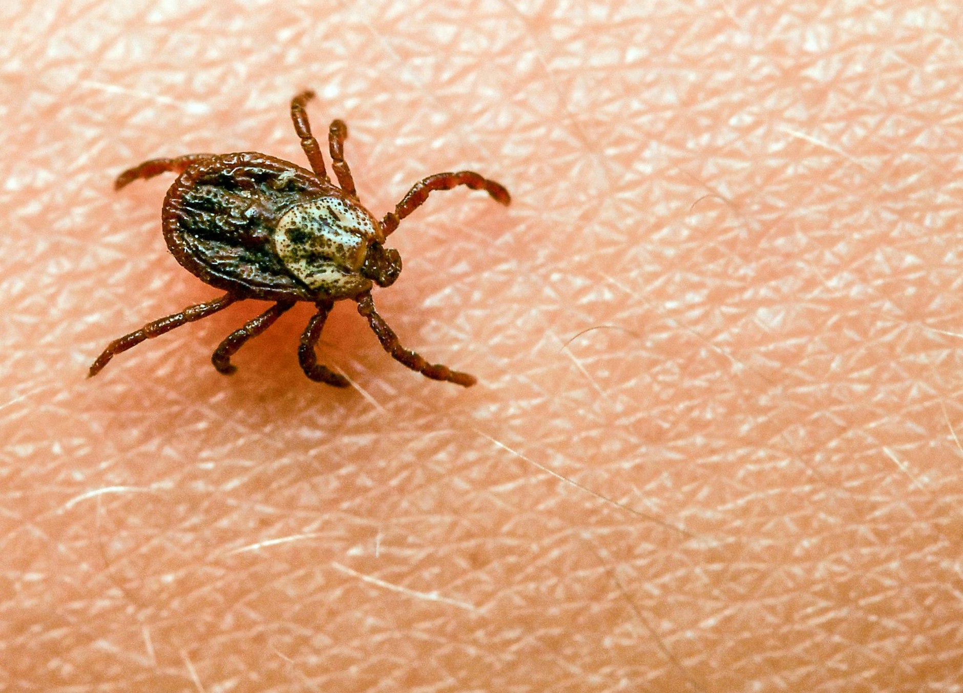 ARCHIV - Eine Zecke krabbelt über den Arm eines Kindes in Sieversdorf (Brandenburg).  a/Symbolbild