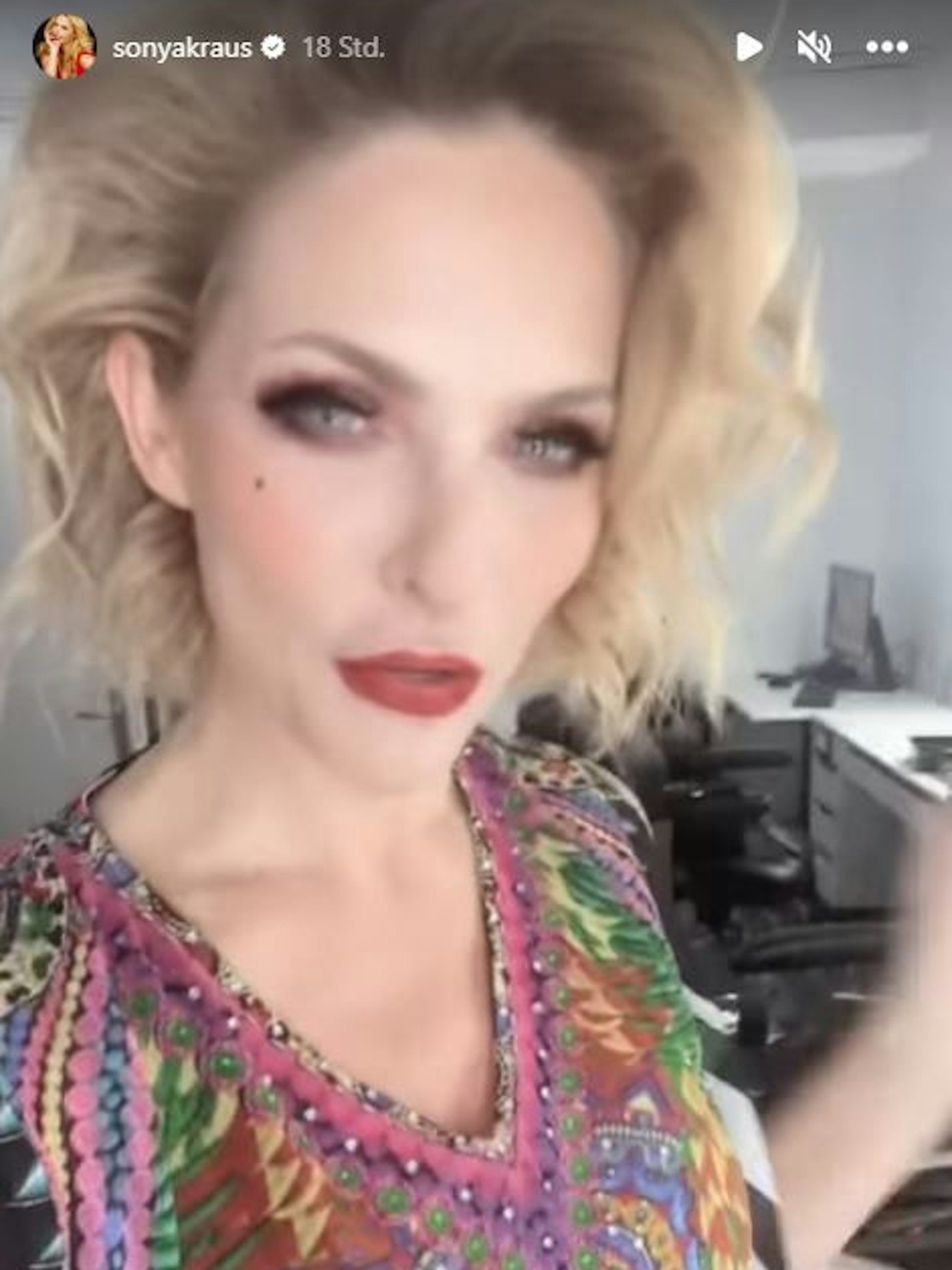 Premiere ohne Perücke: Kraus auf Instagram.