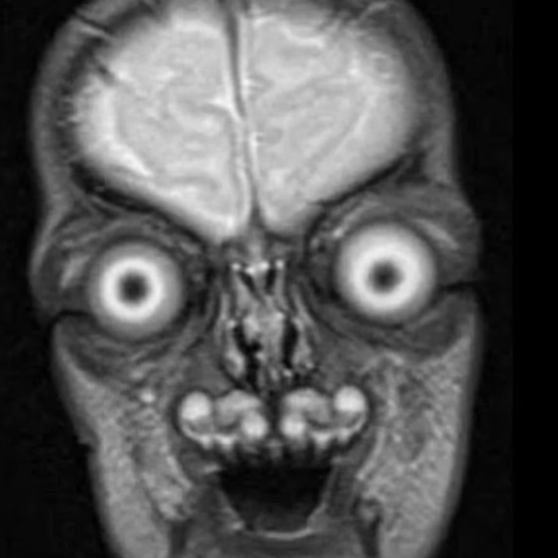 Dieses Ultraschallbild schockte die werdende Mutter.