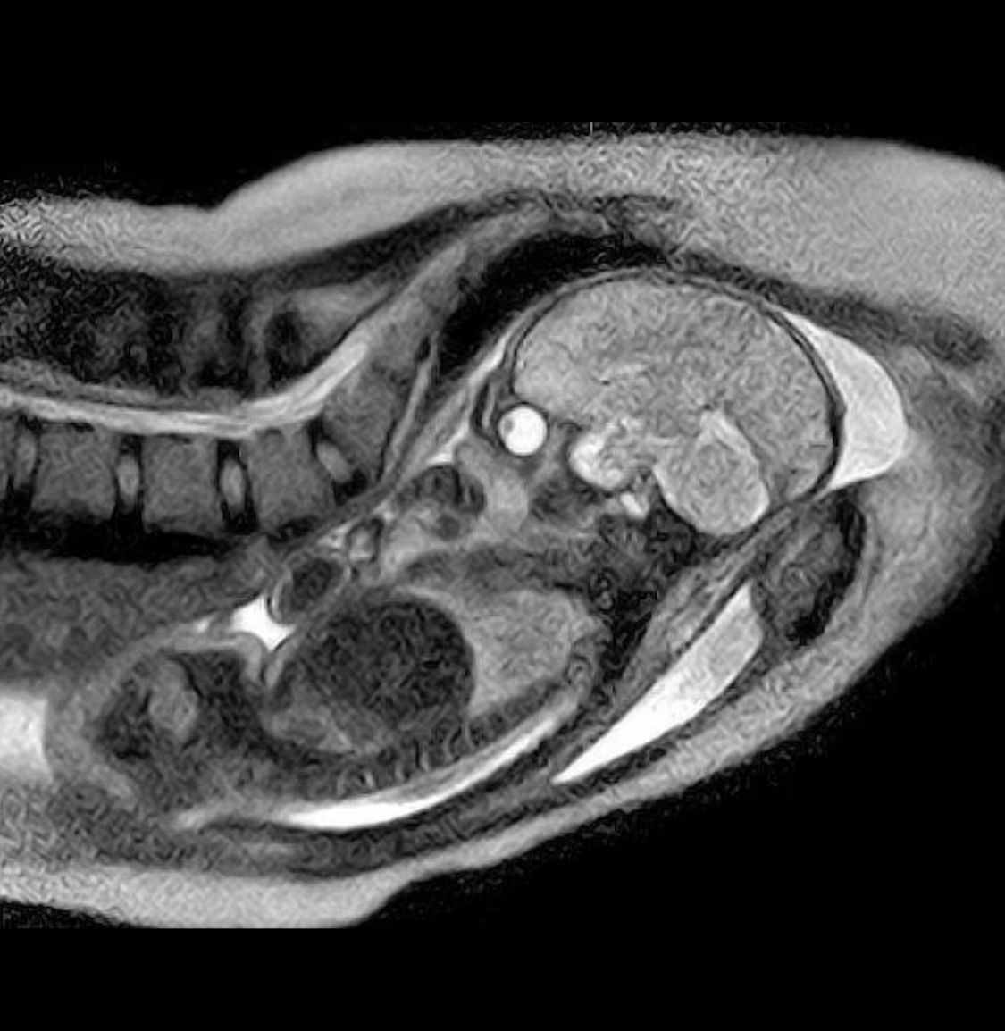 Image - Krasse Ultraschallbilder: Diese Baby sehen aus wie Aliens!