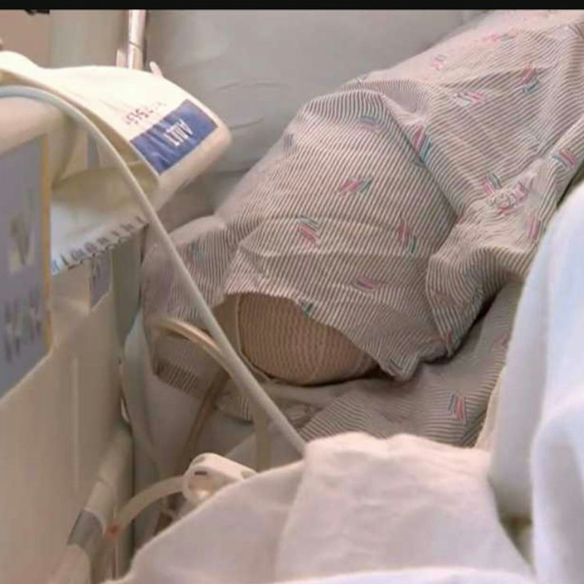 Riveras rechter Arm wurde von einem Alligator abgebissen.