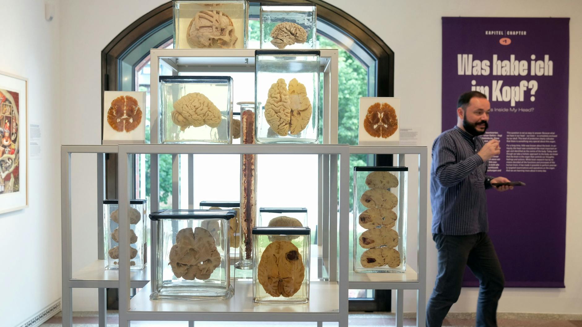 Das Gehirn ist ein faszinierendes Organ, in der Ausstellung erfährt man sehr viel darüber. 