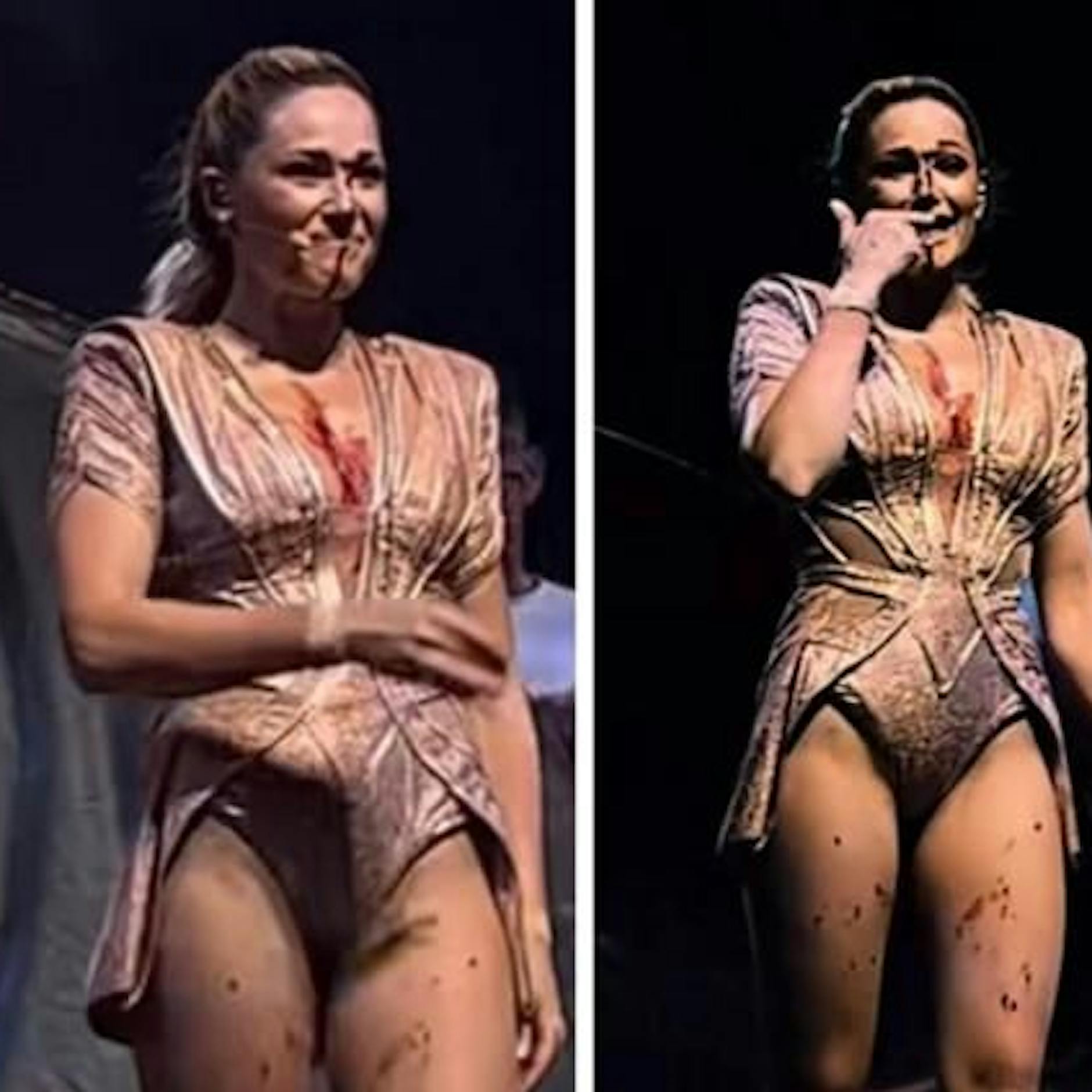 Fans rechnen mit Helene Fischer ab! Heftige Kritik nach Unfall