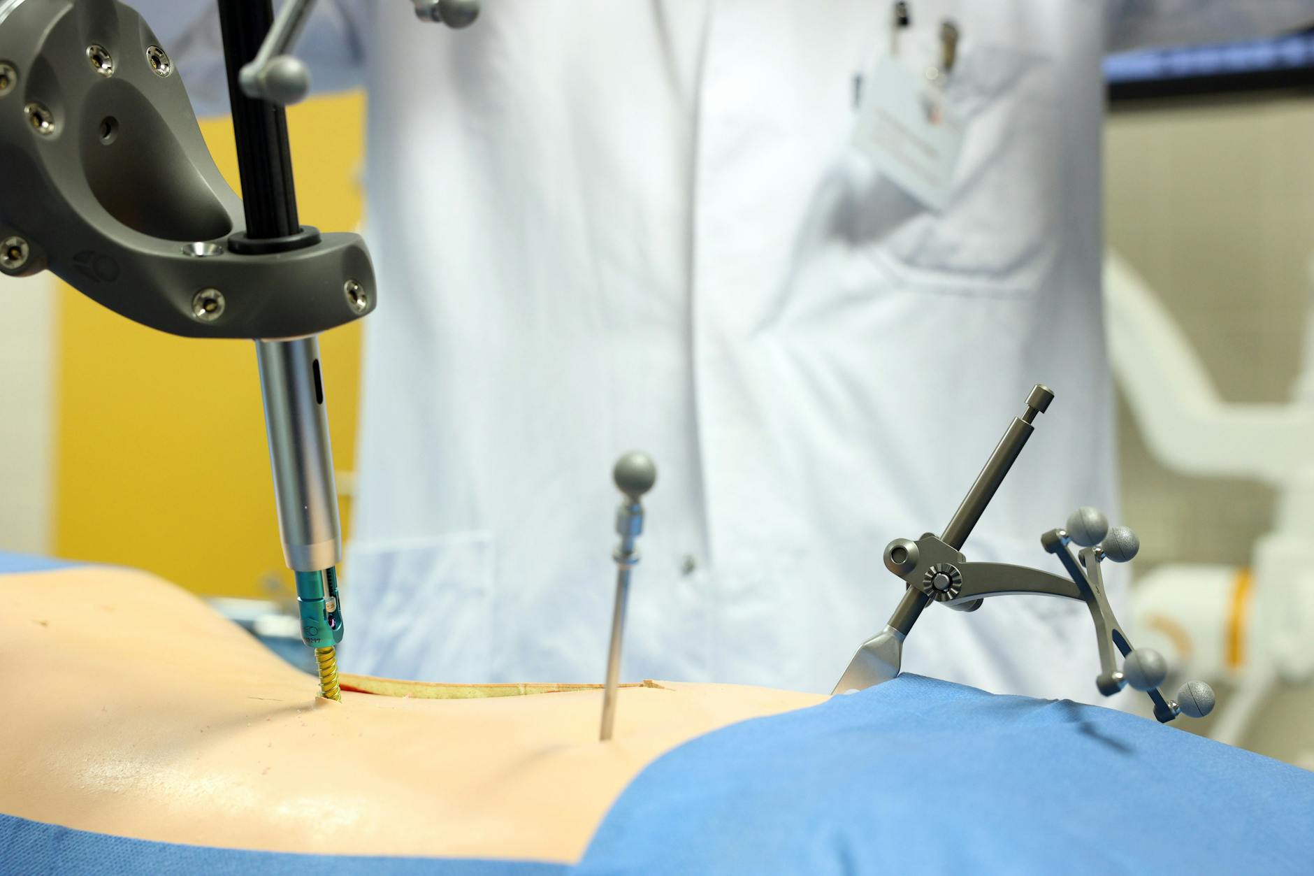 Die neue Technik für Wirbelsäulen-Operationen minimiert Risiken deutlich.