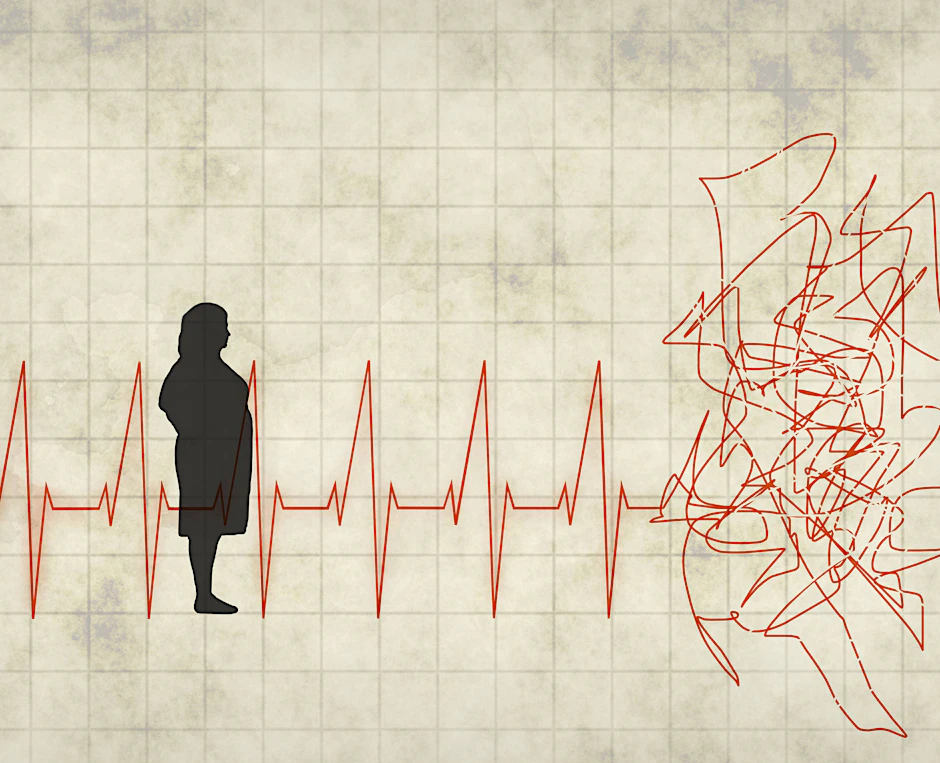 Übergewichtige Frau schaut auf ein verworrenes EKG.