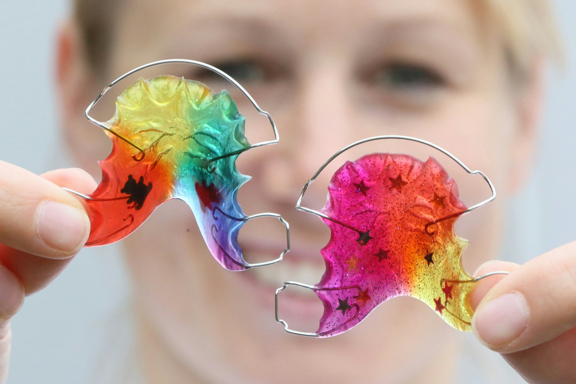 Lose Zahnspangen gibt’s auch in Bunt.