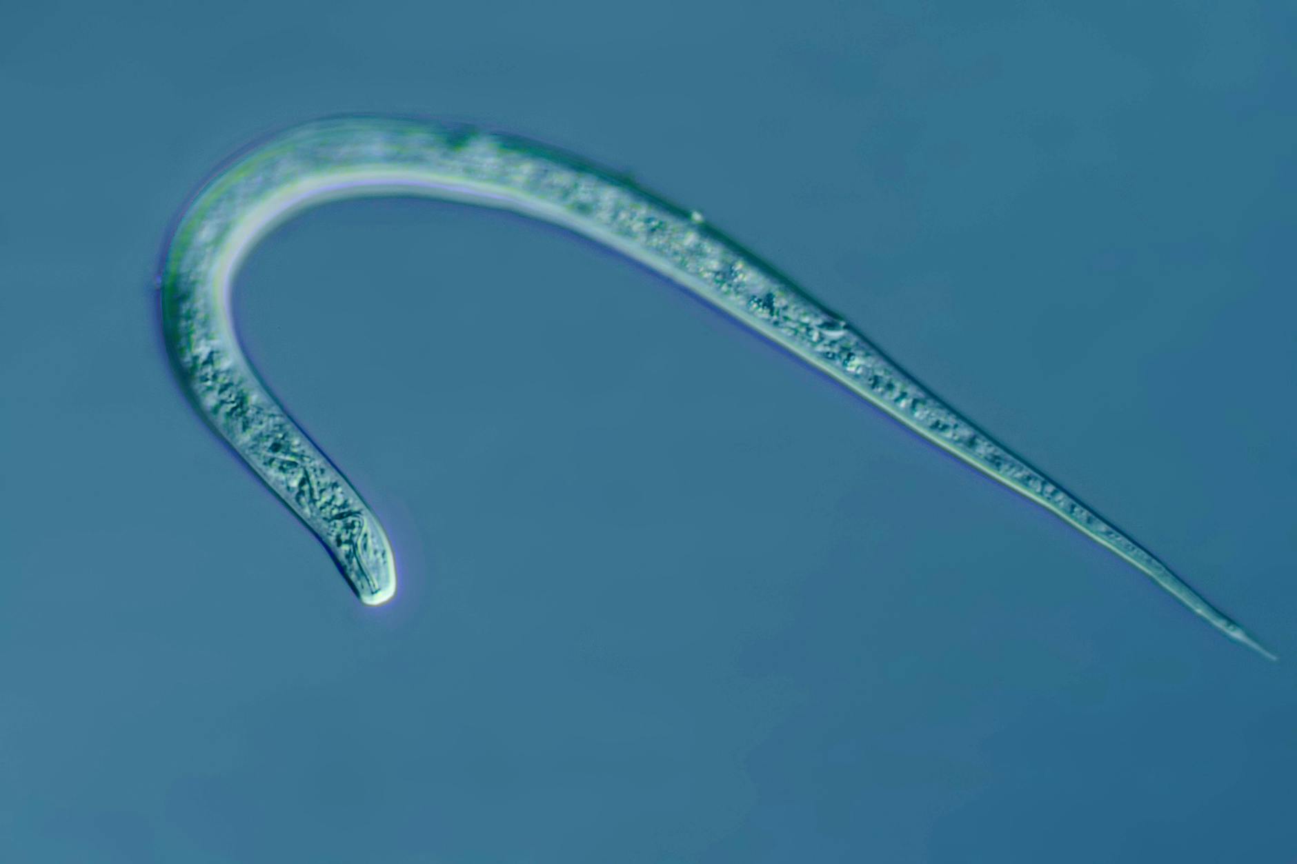 Fadenwurm in starker Vergrößerung