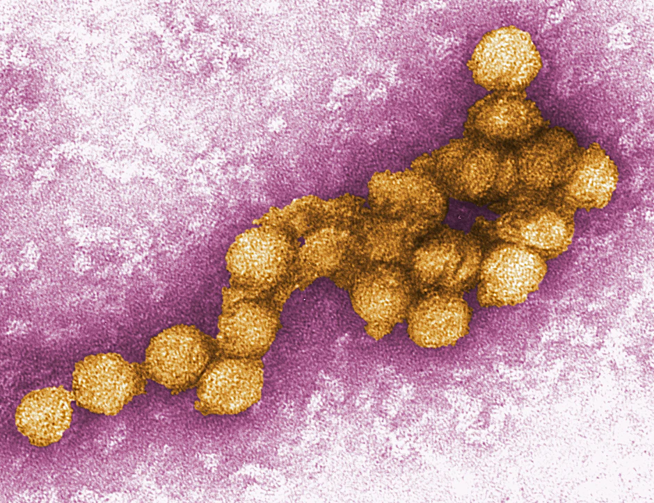 Dieses von den Centers for Disease Control zur Verfügung gestellte Foto zeigt eine elektronenmikroskopische Aufnahme des West-Nil-Virus. 