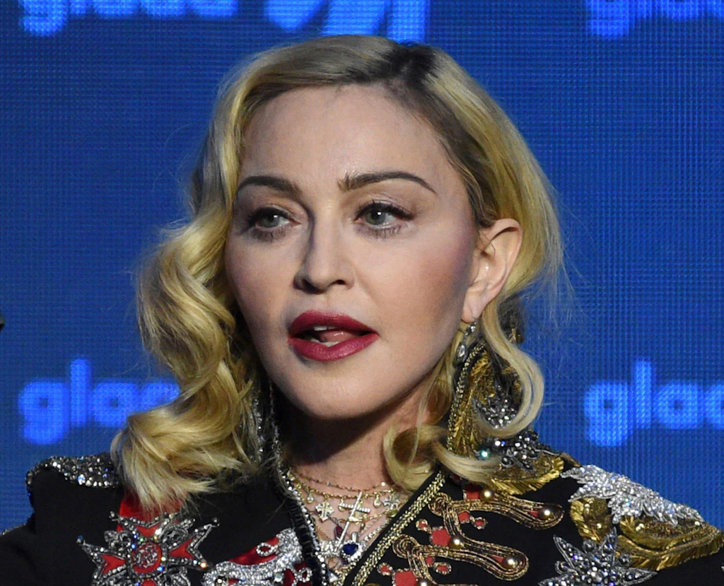 Madonna wird 65 und ist offenbar kränker als gedacht