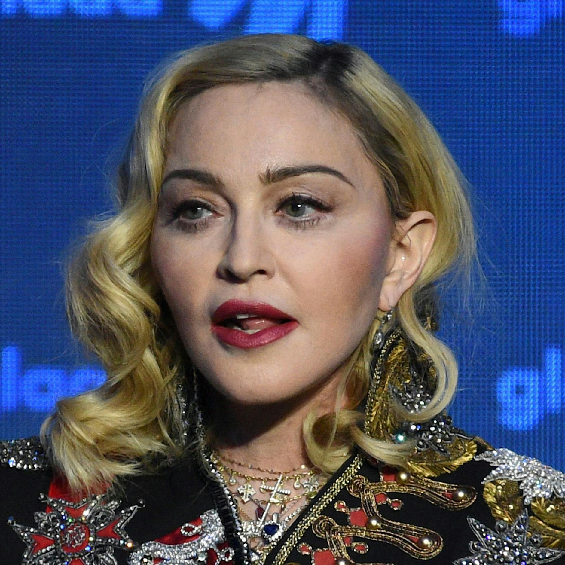 Madonna wird 65 und ist offenbar kränker als gedacht