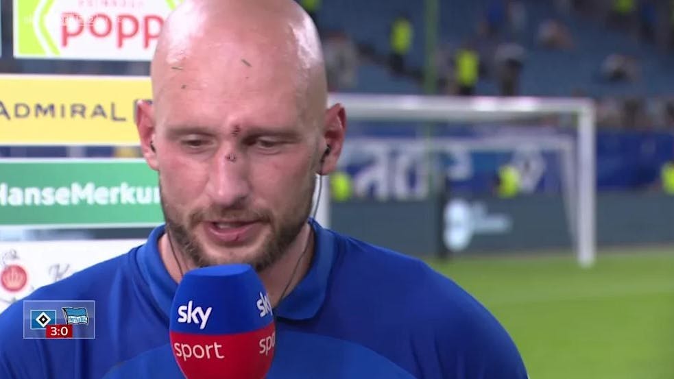 Aua, die Nase von Toni Leistner war offensichtlich gebrochen.