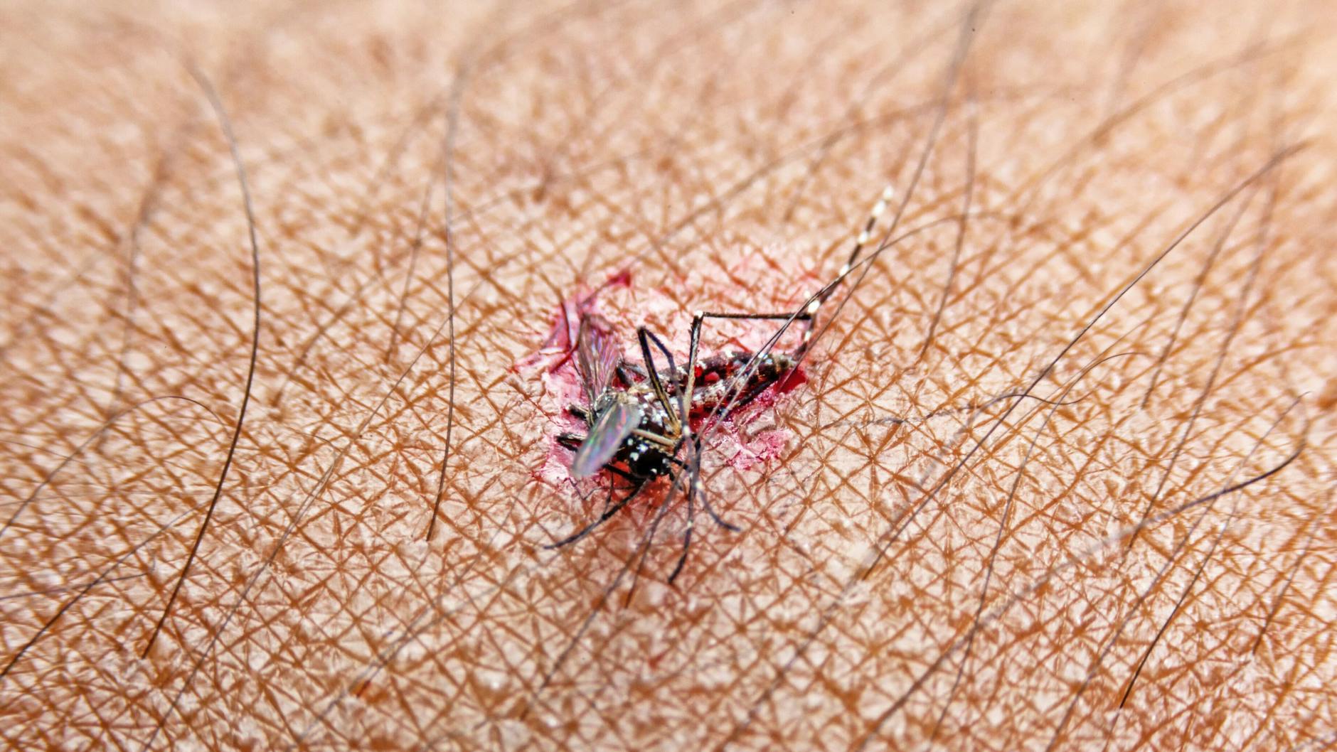 Zerquetschte Mücken auf der Haut lassen sich leicht abwaschen. Aber: Wie wird man die Flecken an der Wand wieder los?