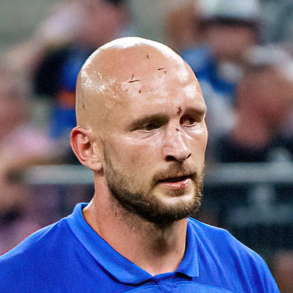 Beim 0:3 in Hamburg spielte Herthas Toni Leistner mit Platzwunde und gebrochener Nase weiter.